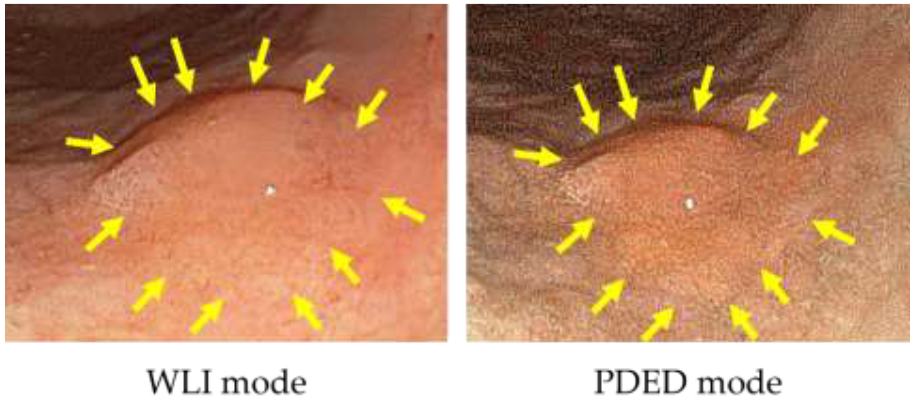 Diagnostics 11 01967 g003 550