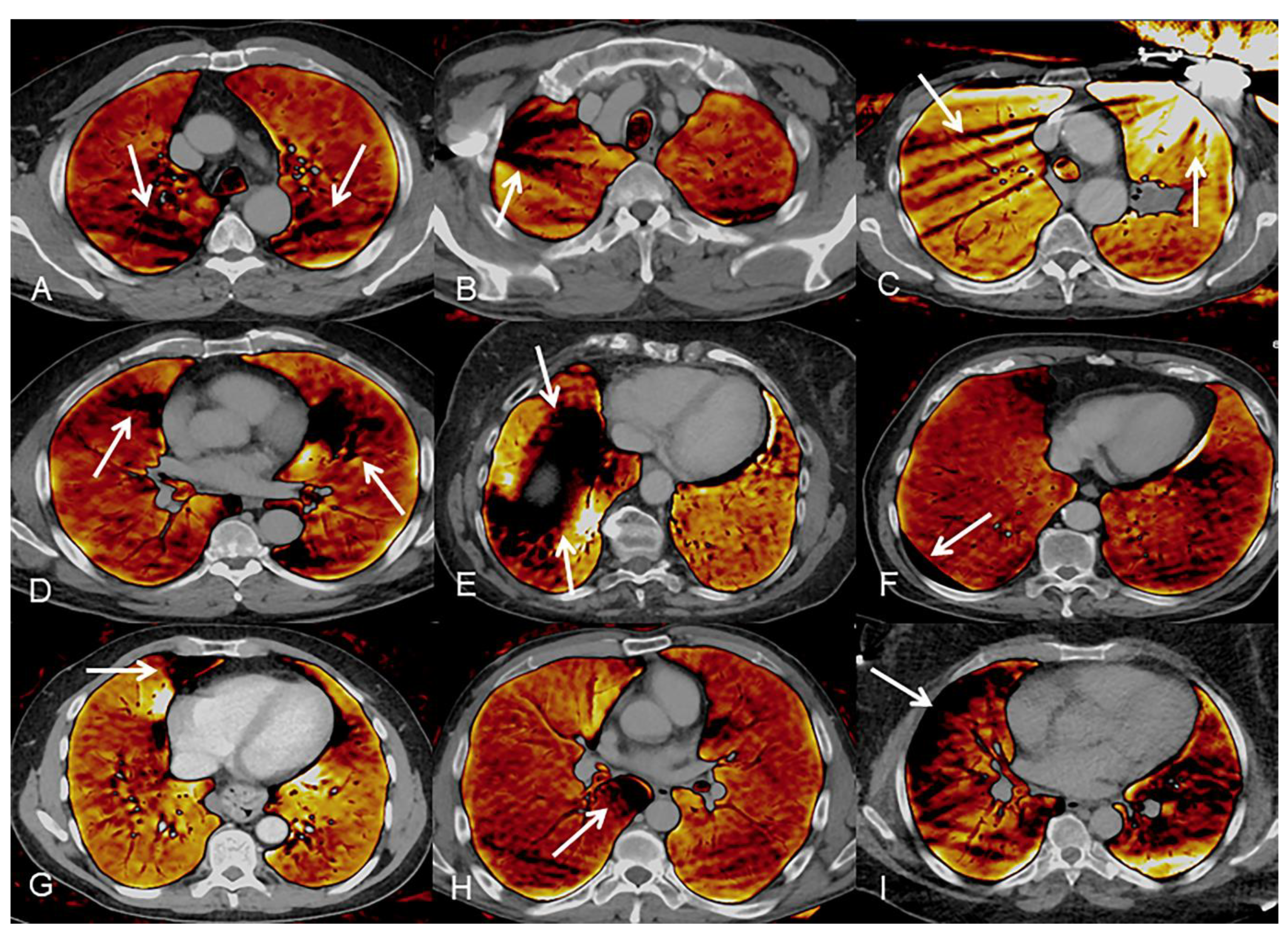 Diagnostics 11 01989 g004