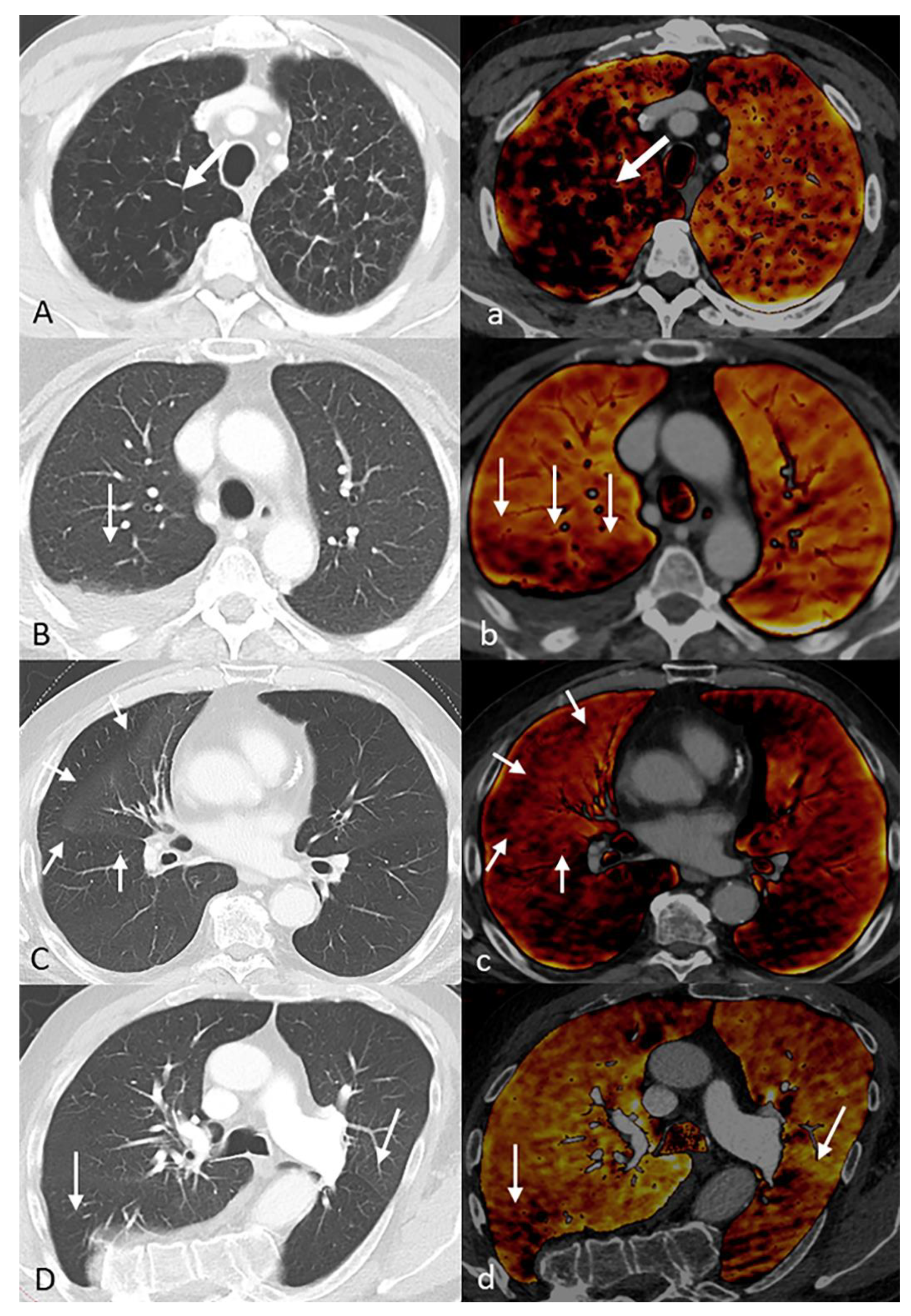 Diagnostics 11 01989 g006