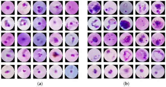 Diagnostics | Free Full-Text | Diagnosing Malaria Patients with Plasmodium  falciparum and vivax Using Deep Learning for Thick Smear Images