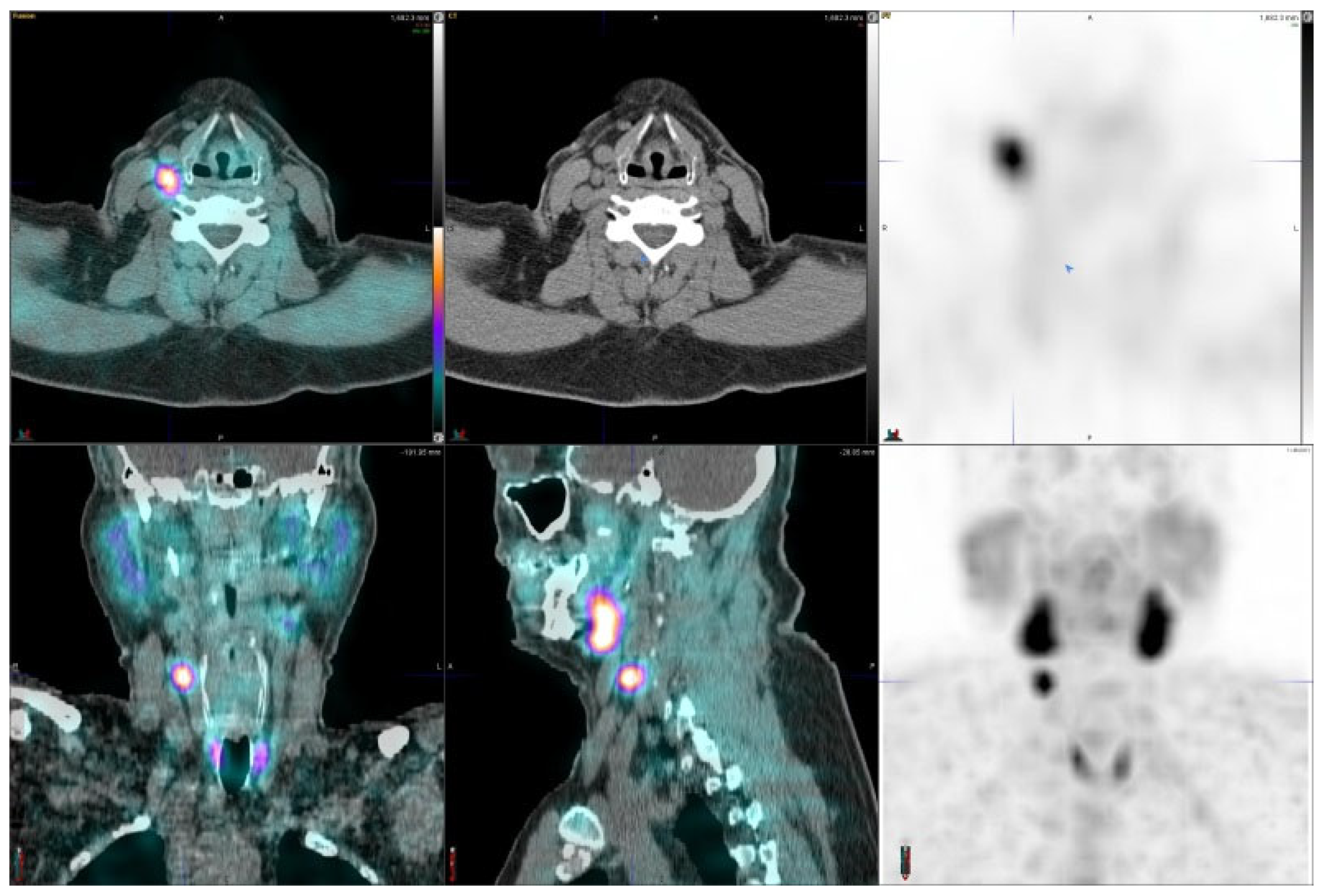 A Prospective Comparative Study of Using Ultrasonography, 4D-CT and ...