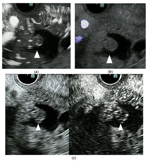 Diagnostics Free FullText A Novel Endoscopic Ultrasonography
