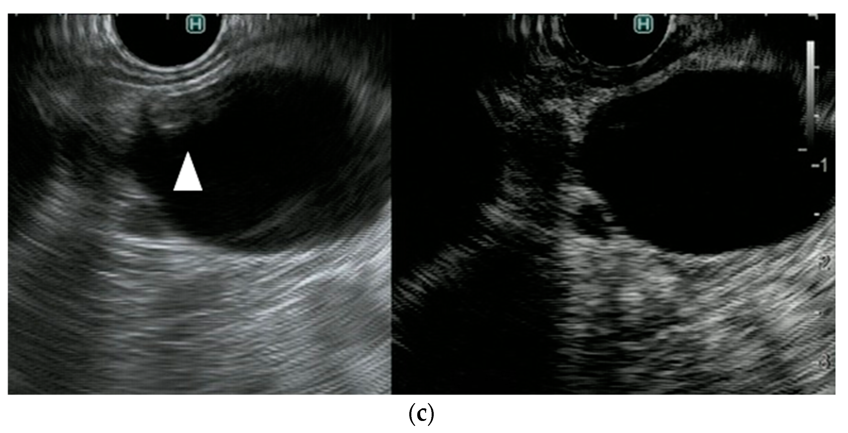 Diagnostics 11 02018 g005b