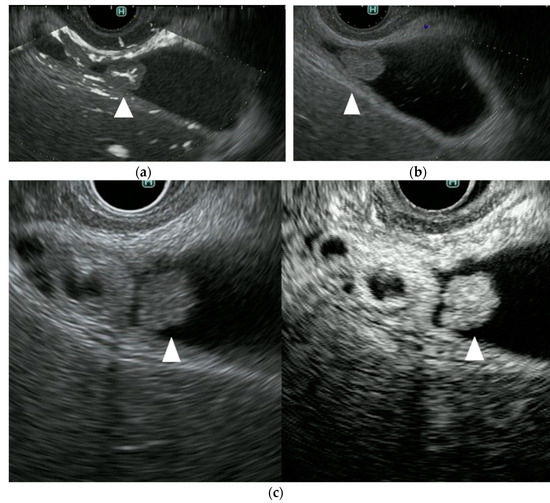 Diagnostics Free FullText A Novel Endoscopic Ultrasonography