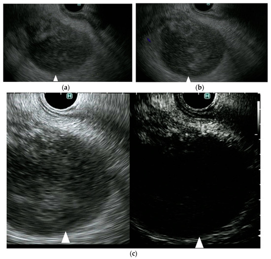 Diagnostics Free FullText A Novel Endoscopic Ultrasonography