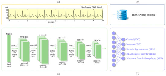 AI-Enabled Algorithm for Automatic Classification of Sleep Disorders ...