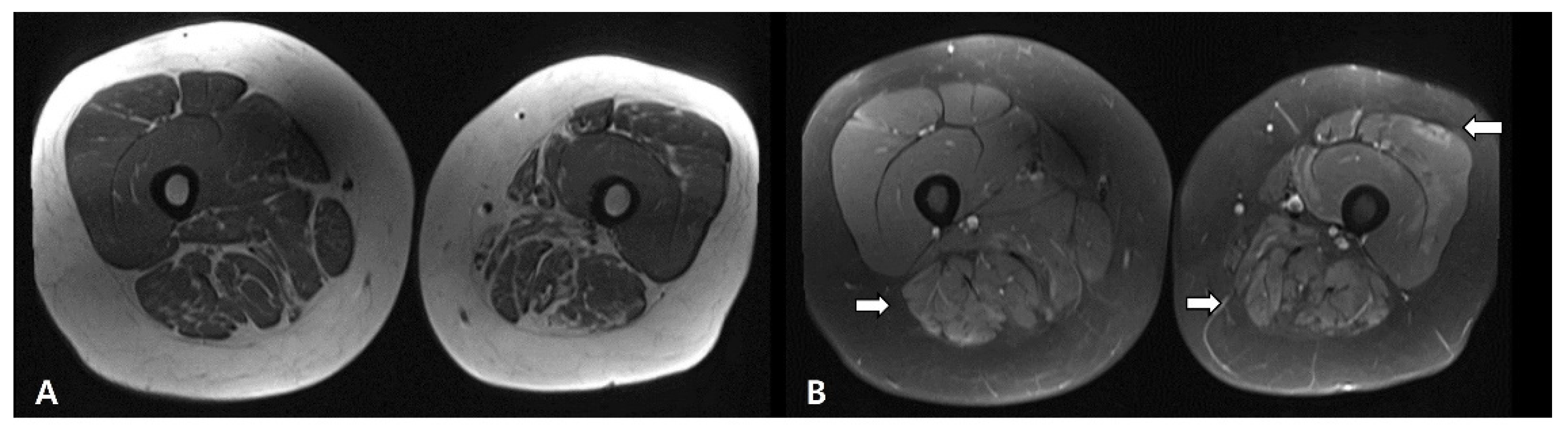 Diagnostics 11 02064 g002 550