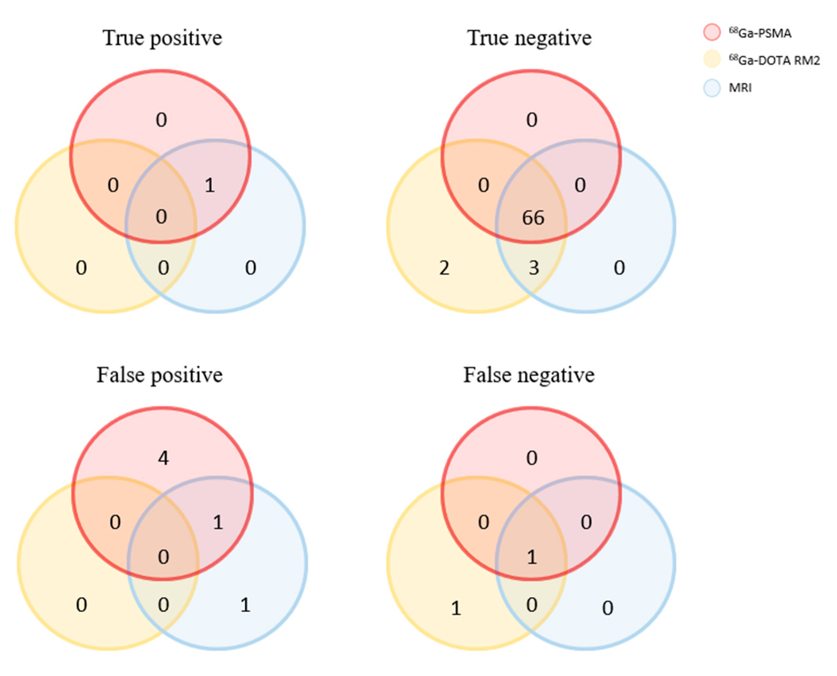 True positive false negative. True positive true negative. True positive true negative круговая диаграмма. Задача круги Эйлера "Юпитер & (Марс | Сатурн)".