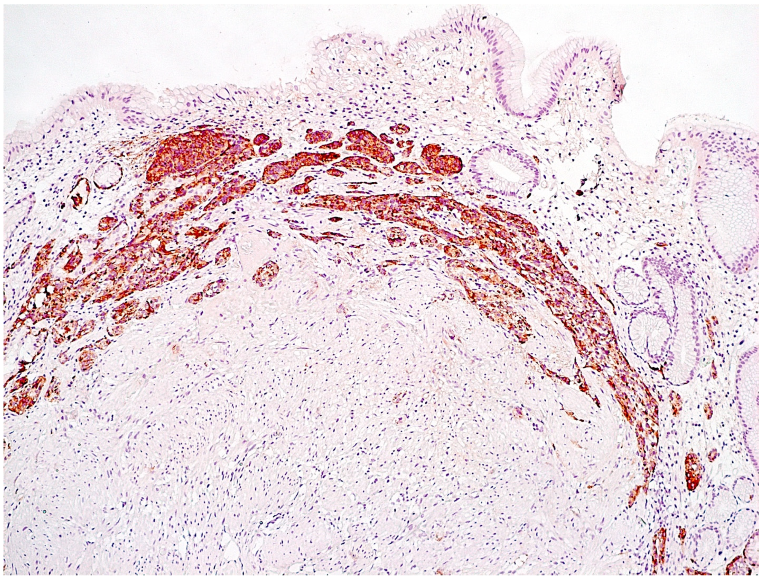 Diagnostics 11 02113 g005 Diagnostics 11 02113 g005