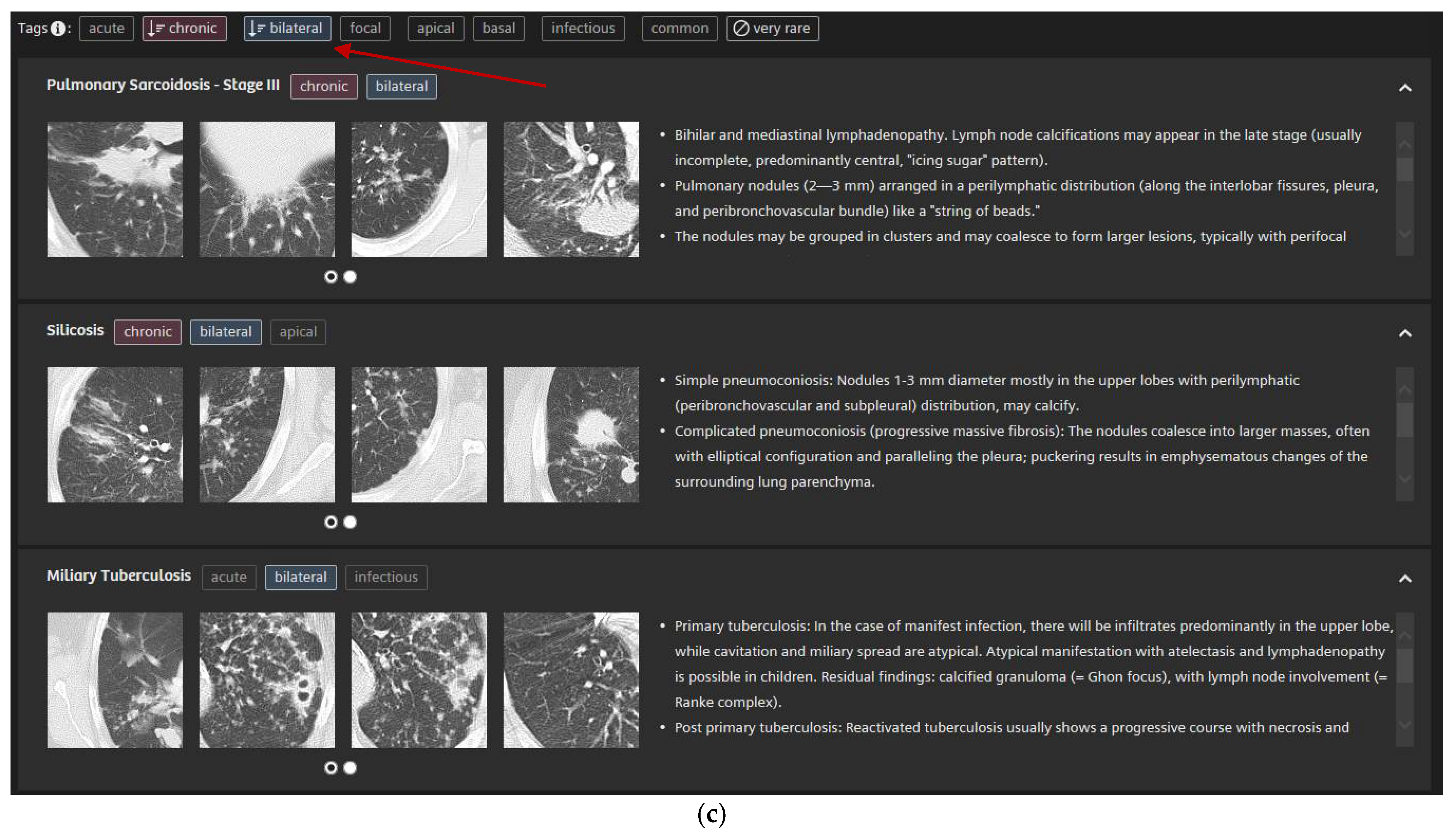 Diagnostics 11 02114 g003b