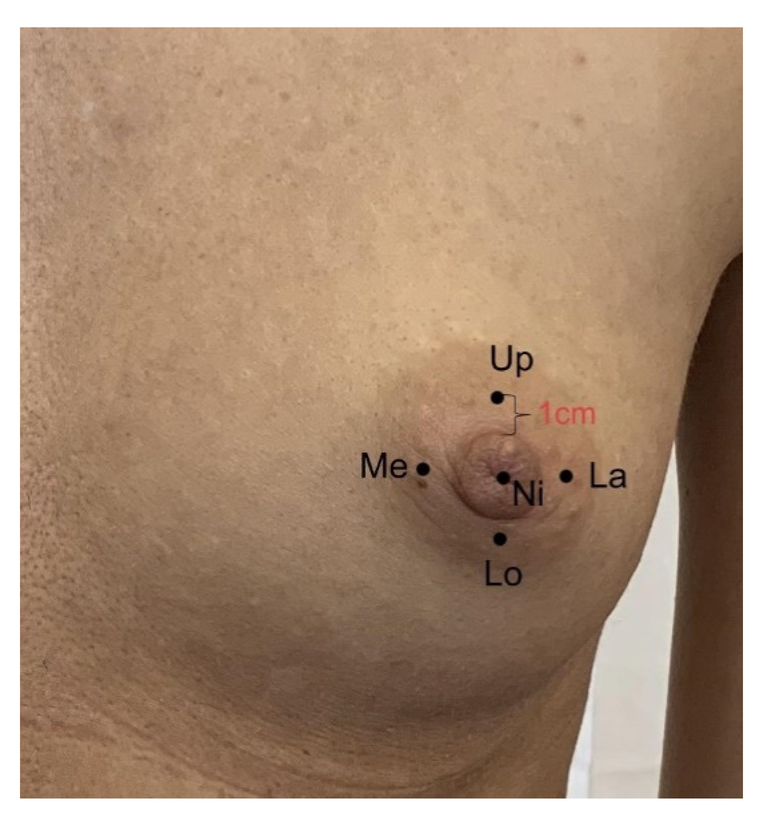 Nipple pictures