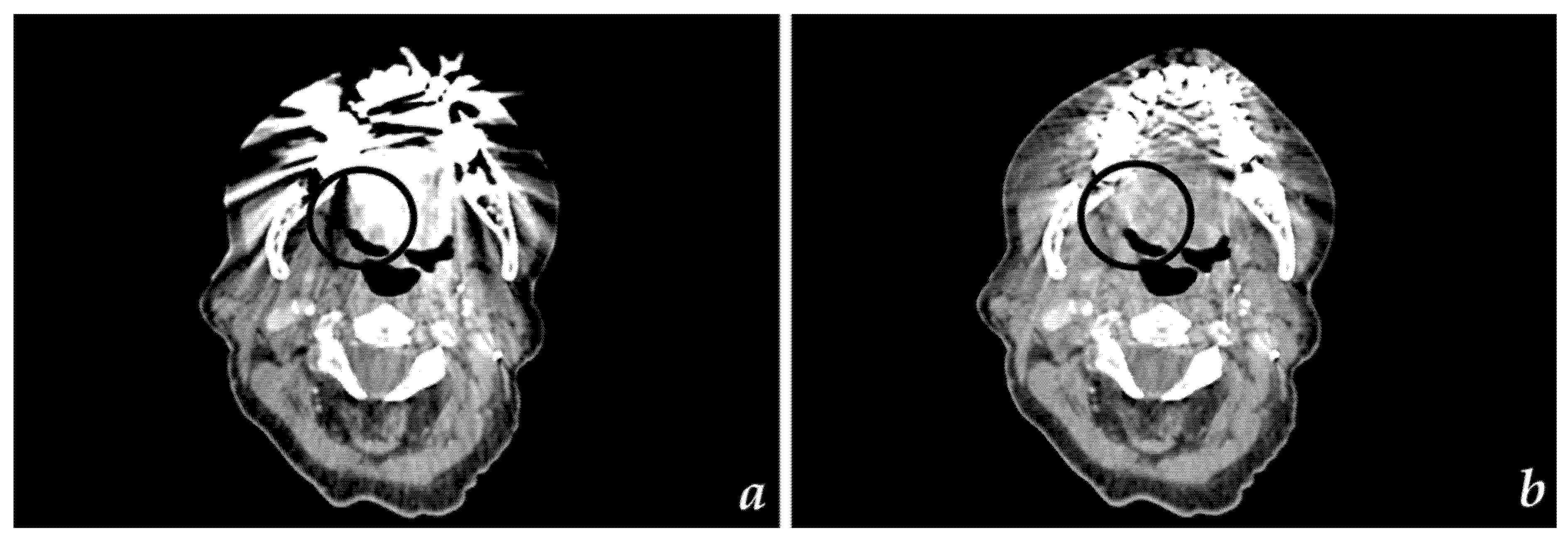 Clinical update on head and neck cancer: molecular biology