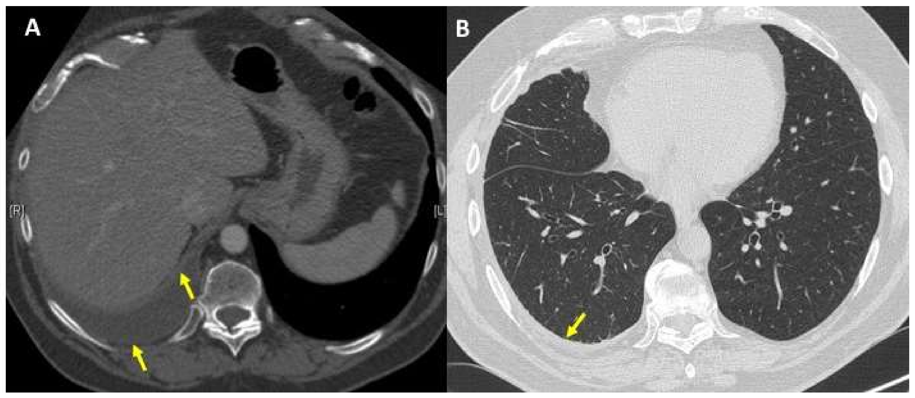 Diagnostics 11 02177 g001 550