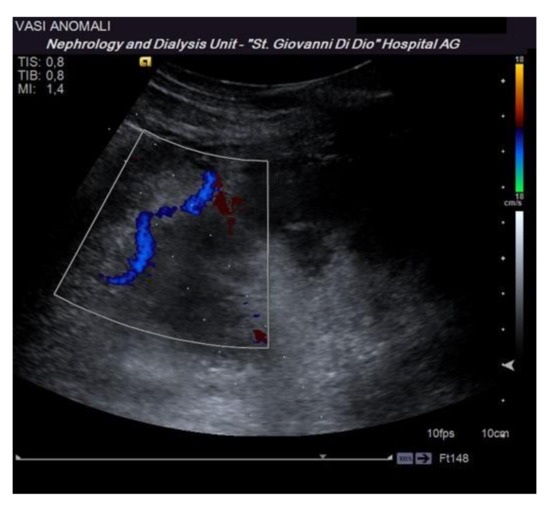 Diagnostics Free FullText Performing an UltrasoundGuided