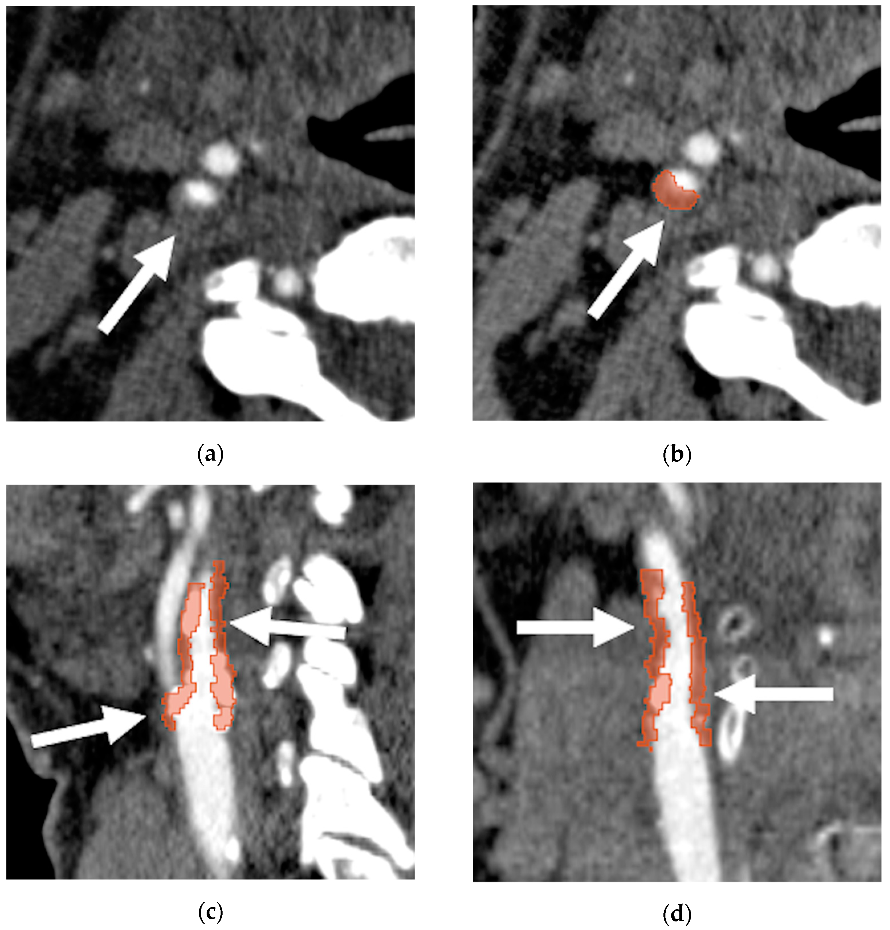 Diagnostics 11 02214 g002