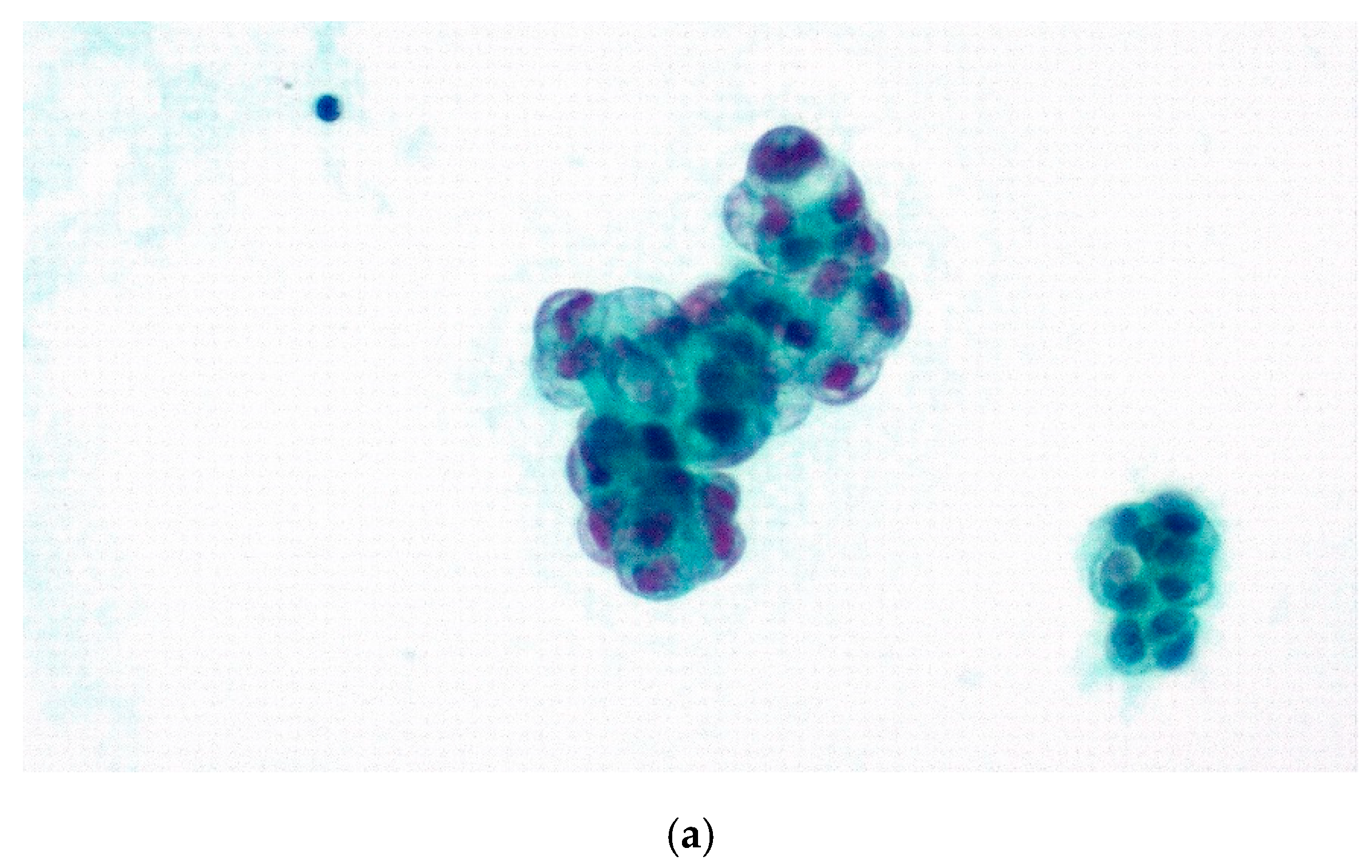 Diagnostics 11 02223 g003a 550