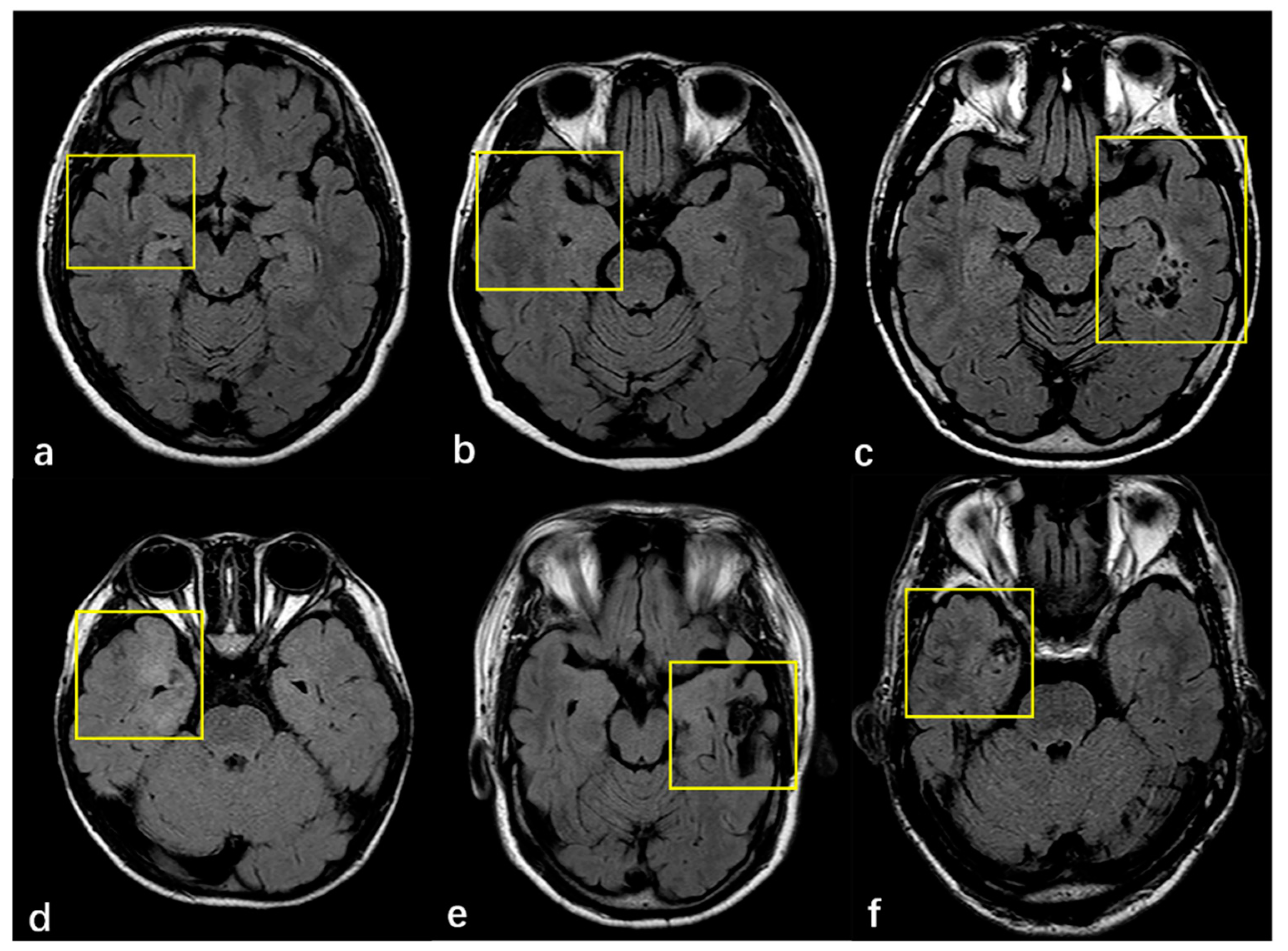 Diagnostics 11 02225 g002
