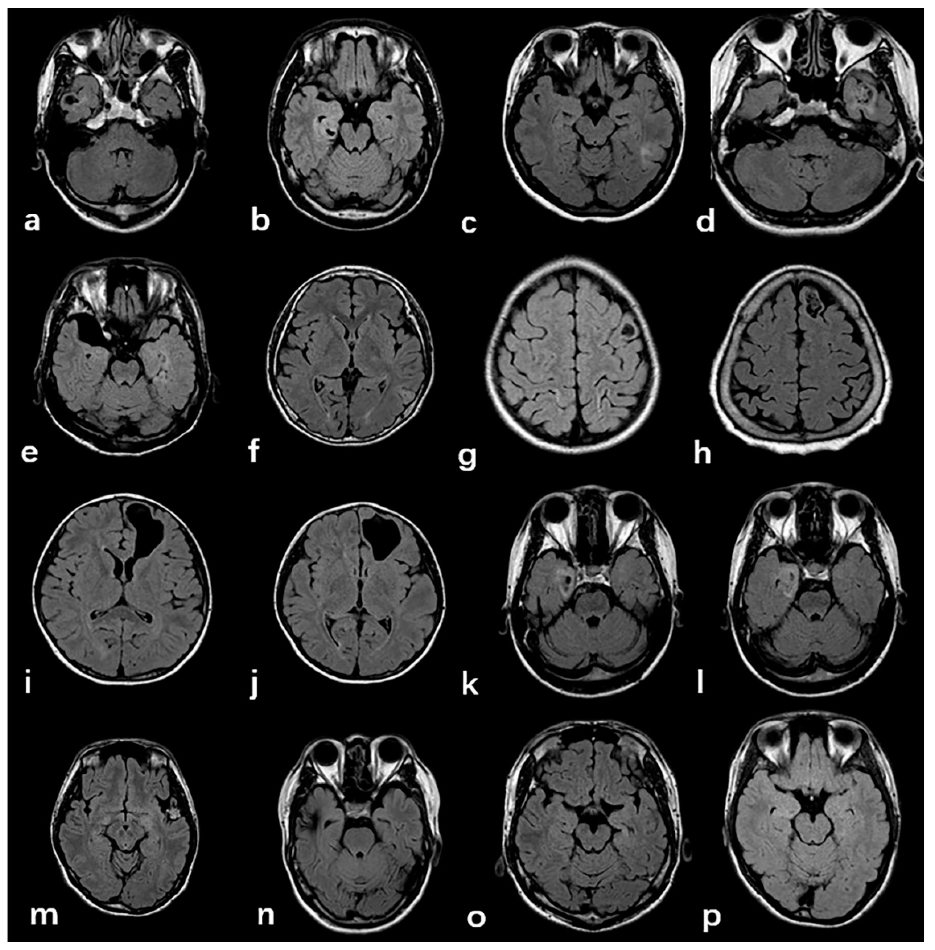 Diagnostics 11 02225 g003