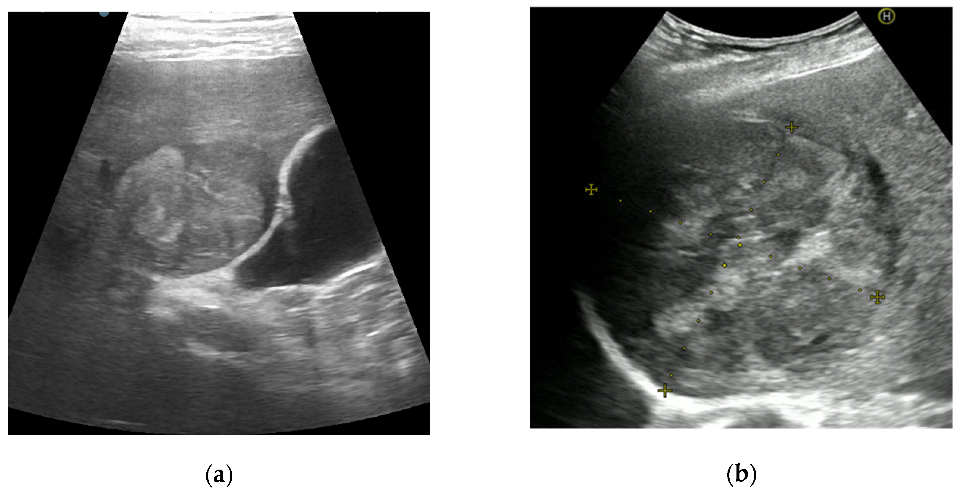 Diagnostics 11 02232 g002