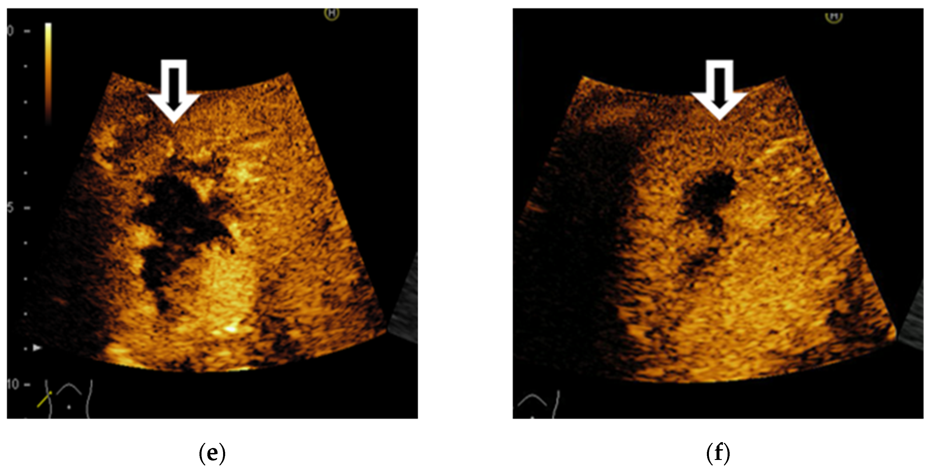 Diagnostics 11 02232 g005b