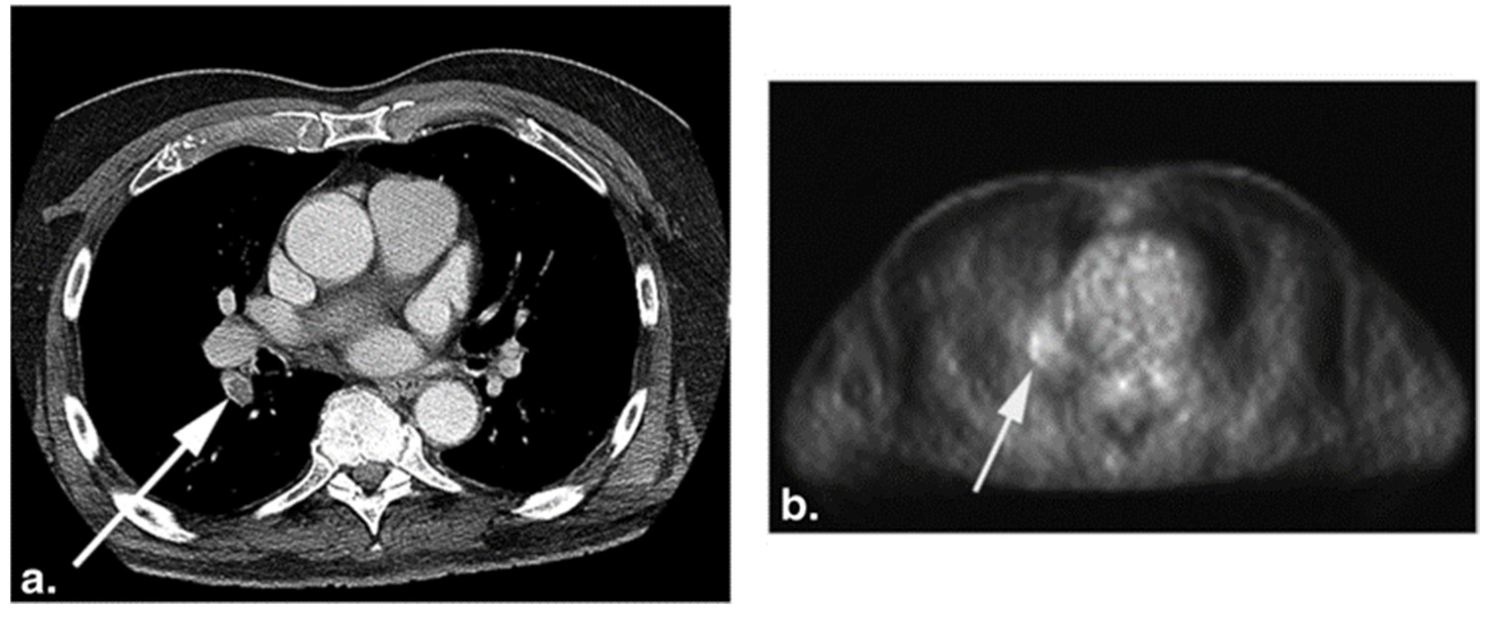 Diagnostics 11 02234 g004 Diagnostics 11 02234 g004