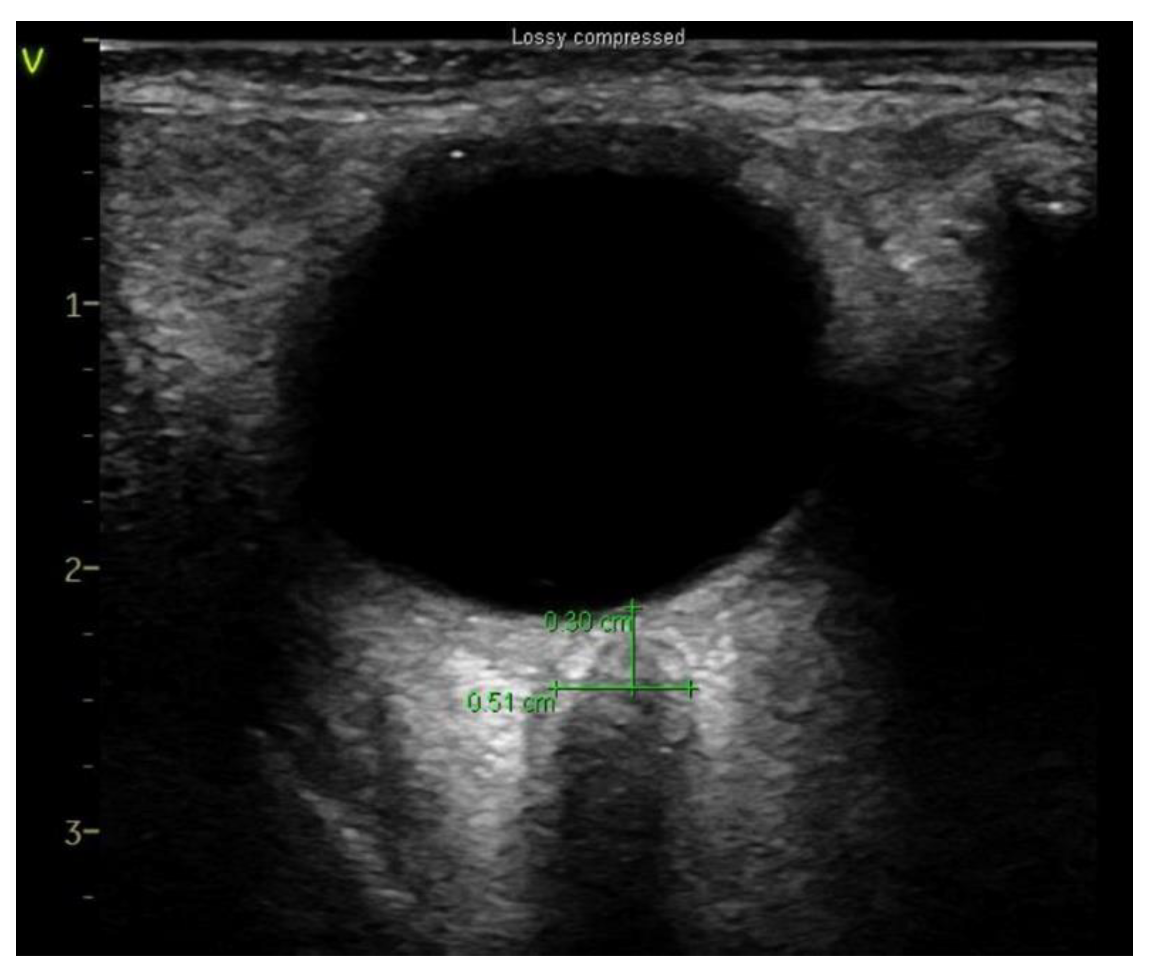 Diagnostics 11 02260 g001 Diagnostics 11 02260 g001