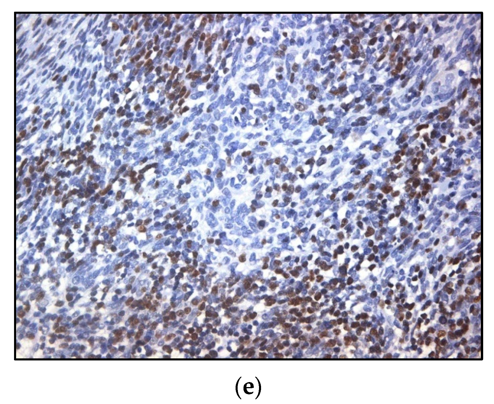 Diagnostics 11 02265 g004b Diagnostics 11 02265 g004b