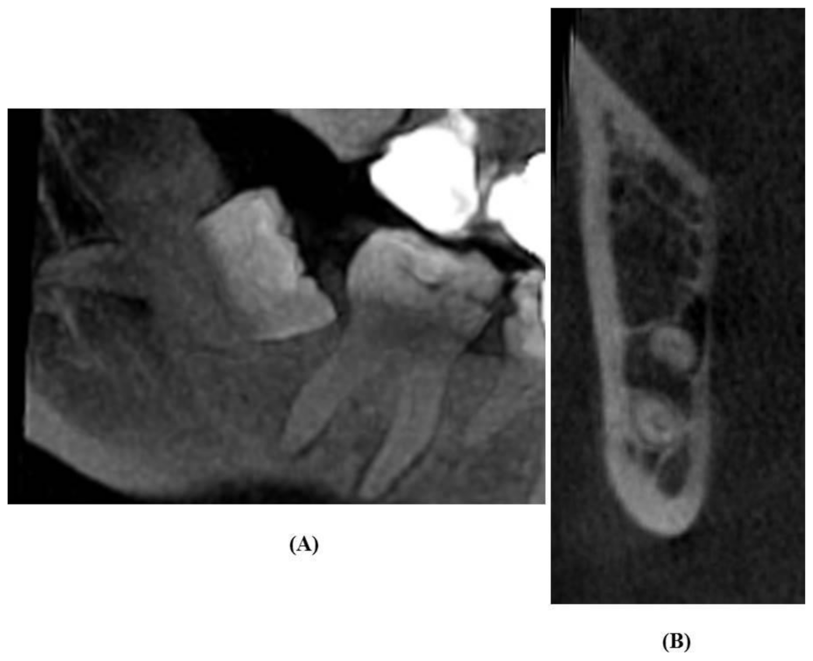 Diagnostics 11 02282 g003 Diagnostics 11 02282 g003