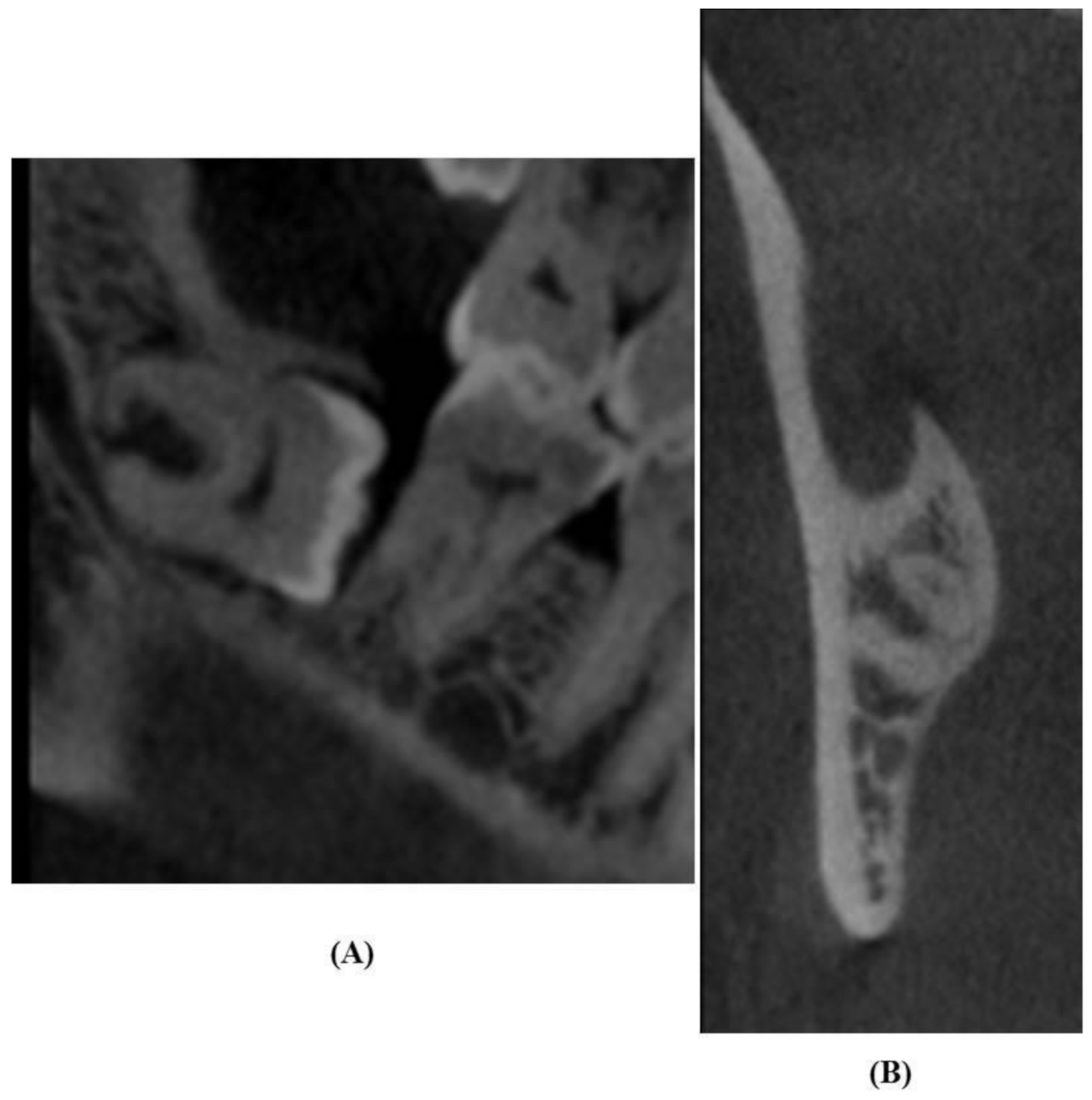 Diagnostics 11 02282 g004 Diagnostics 11 02282 g004