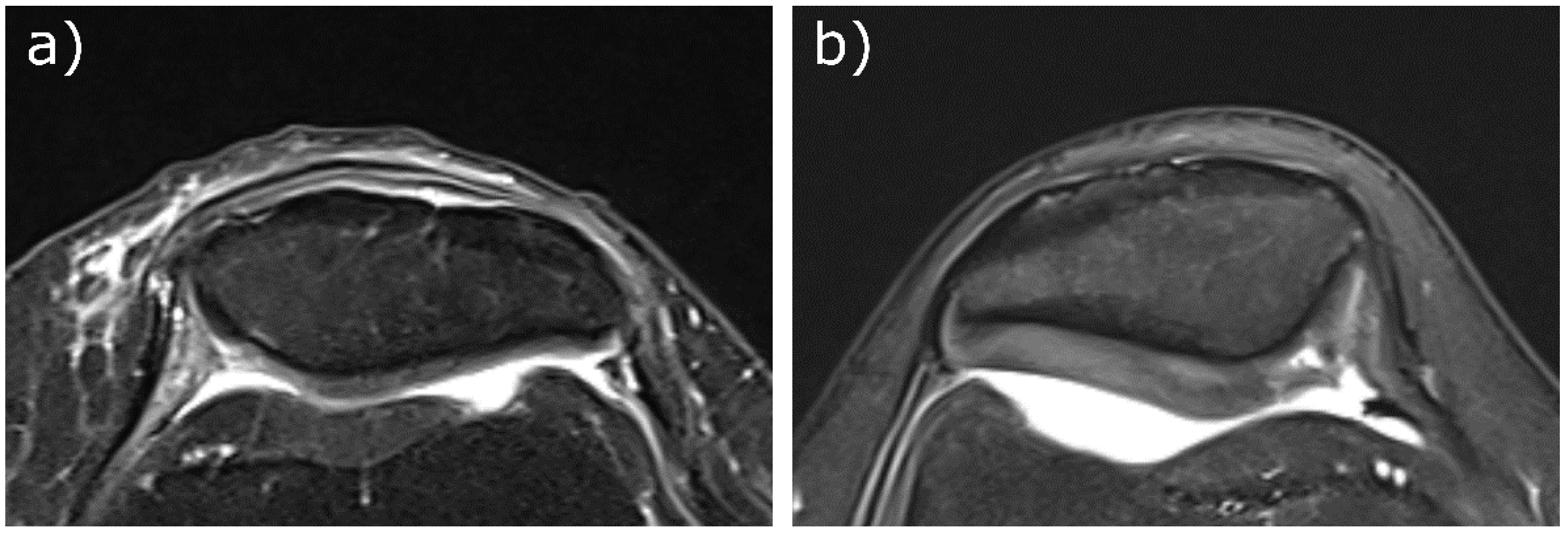 Diagnostics 11 02301 g004 Diagnostics 11 02301 g004