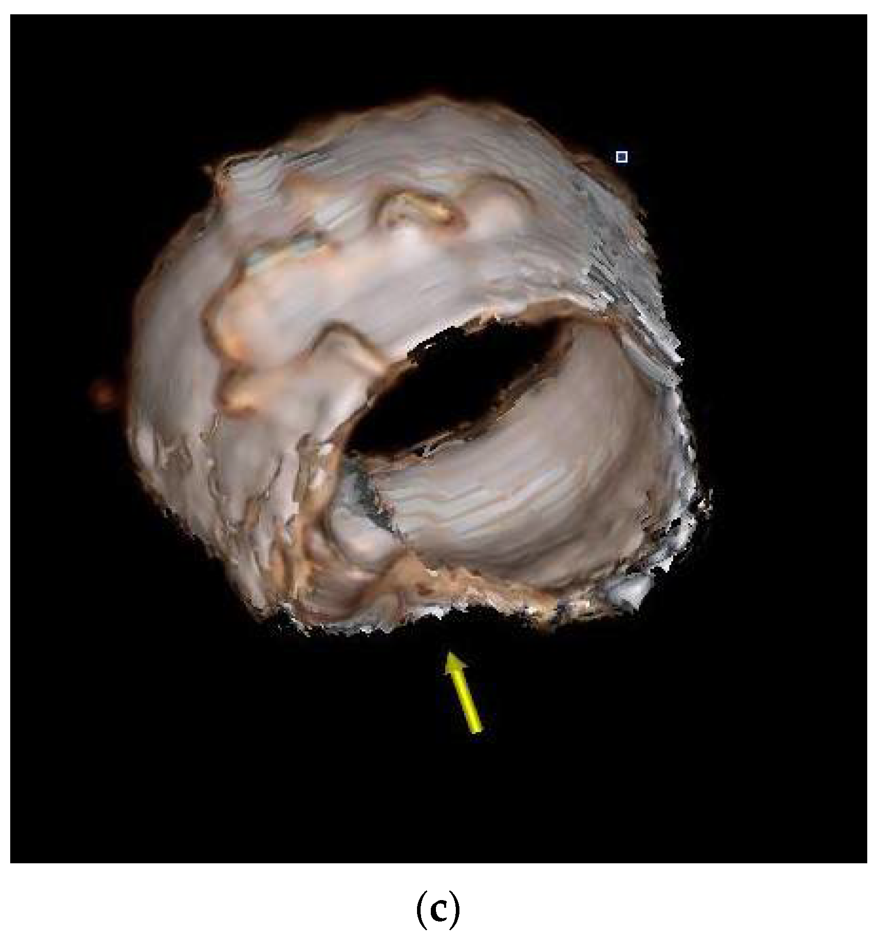 Diagnostics 11 02305 g004b 550