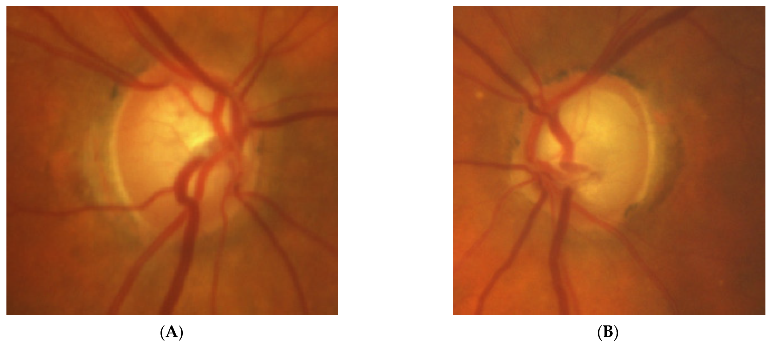 Diagnostics 11 02374 g005a