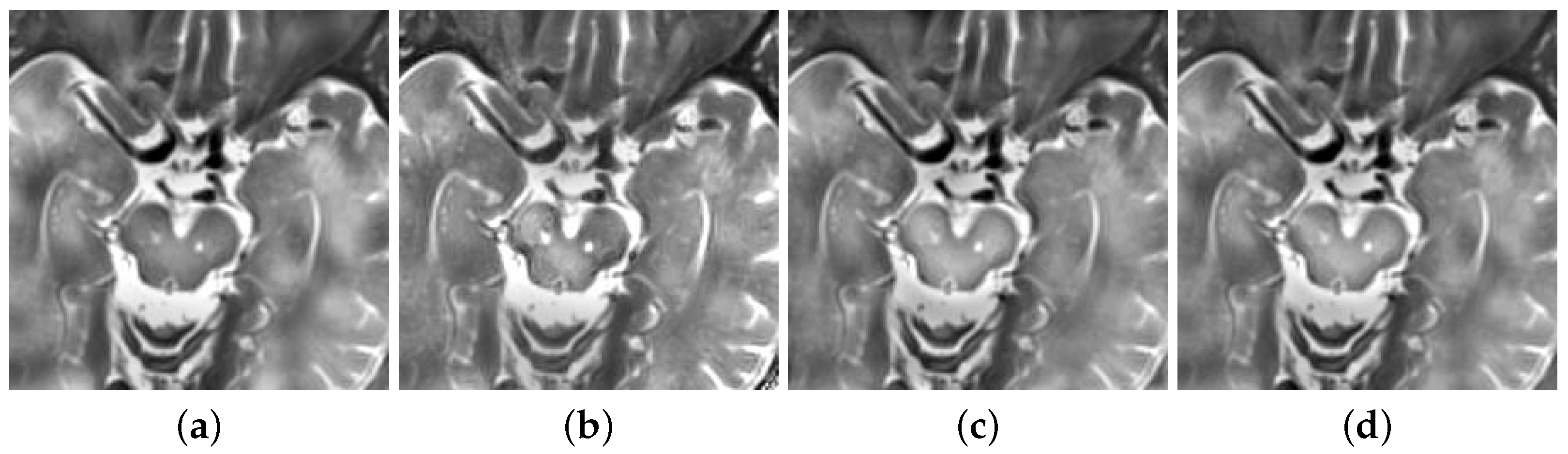 Diagnostics 11 02379 g012