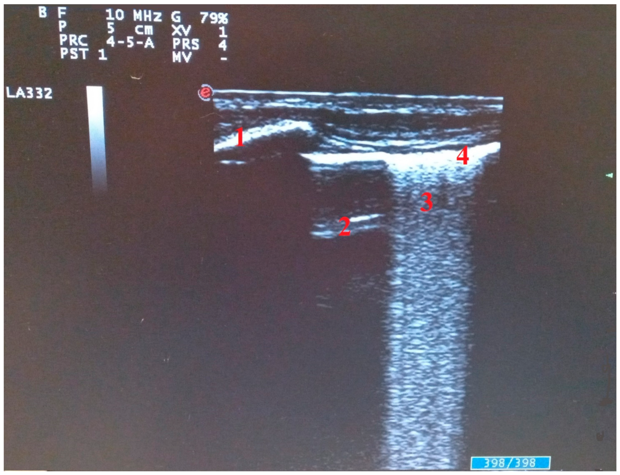 Diagnostics 11 02381 g002 550