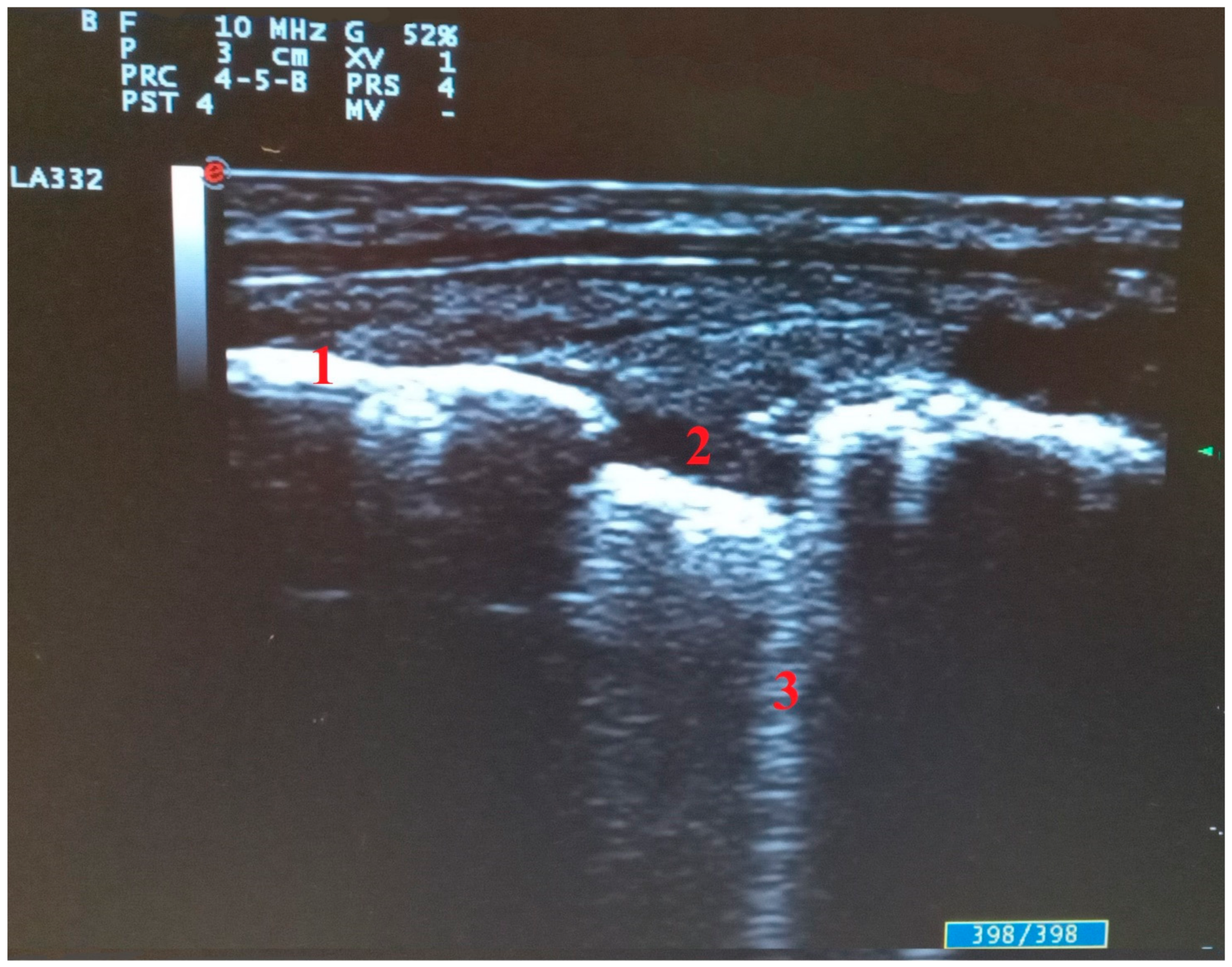 Diagnostics 11 02381 g004 550