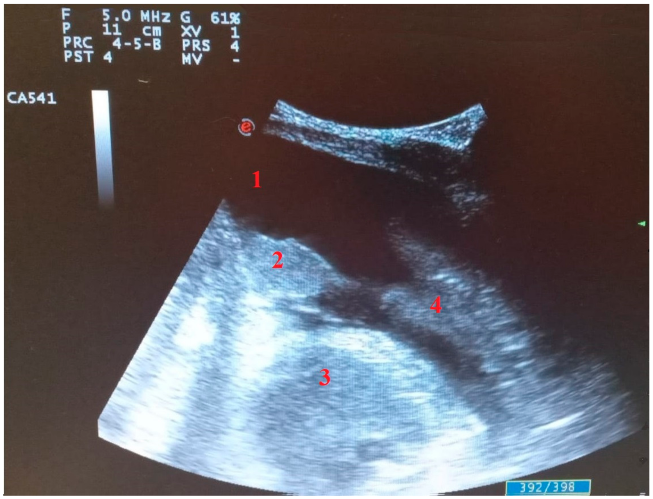 Diagnostics 11 02381 g005 550