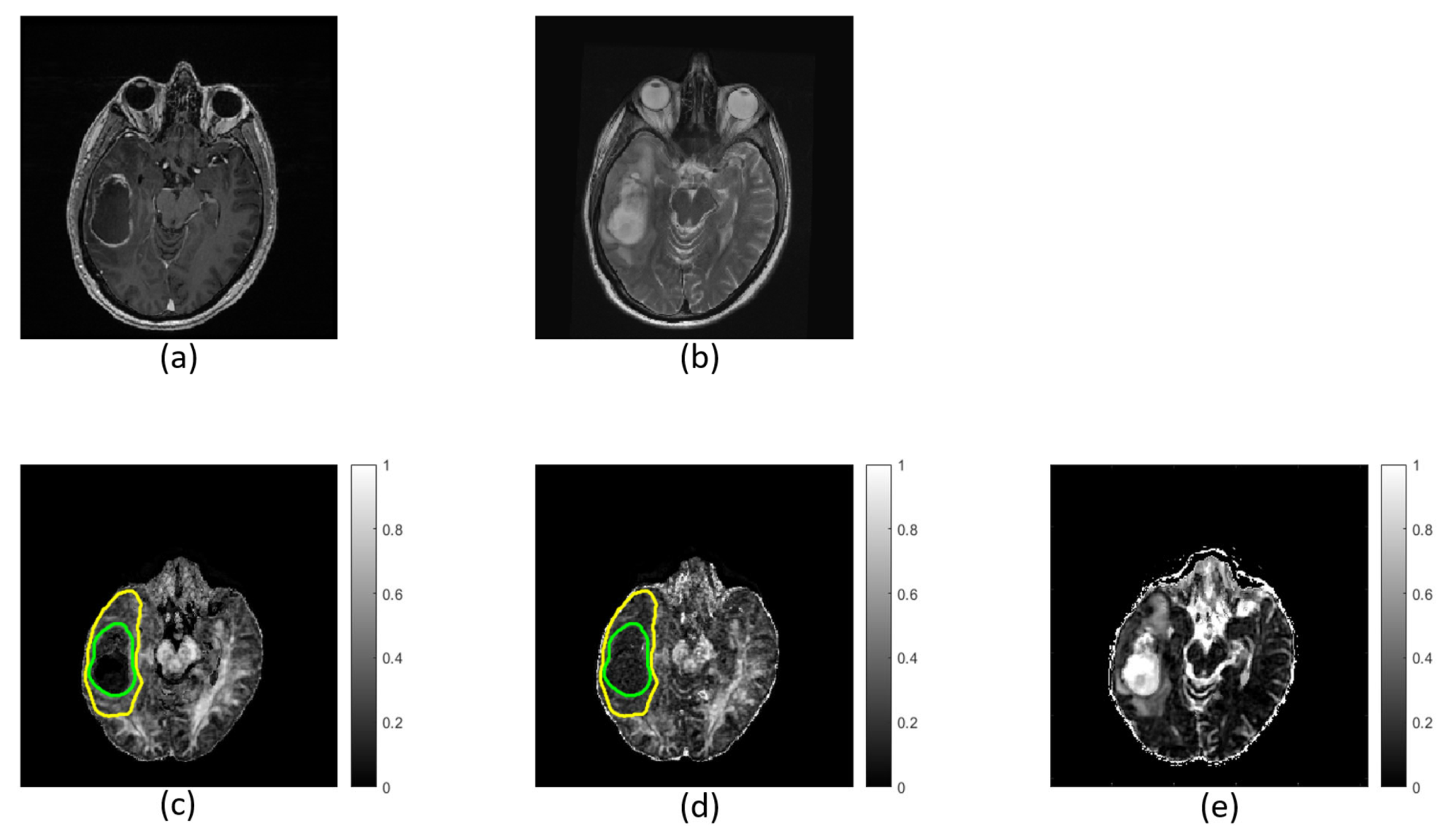 Diagnostics 11 02385 g005 Diagnostics 11 02385 g005