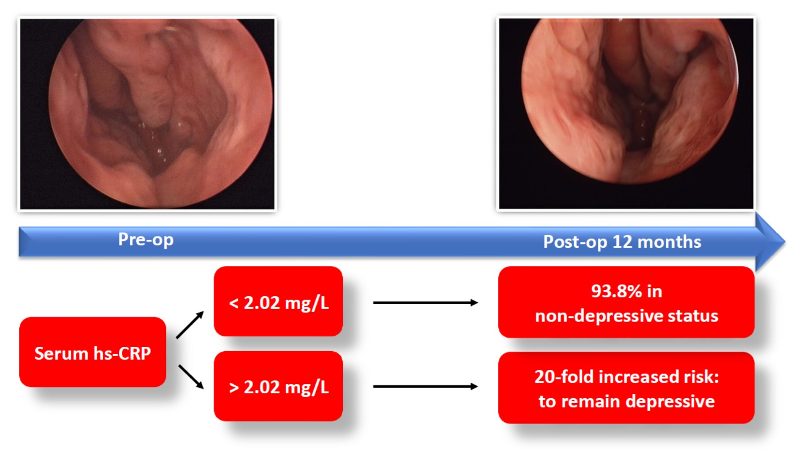 Diagnostics Free FullText Serum HighSensitivity CReactive Protein Is Associated with