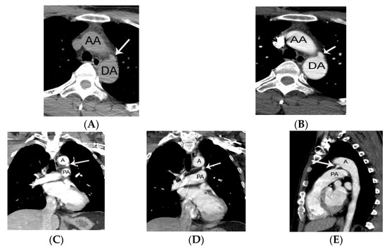 cardiac PICU スタンダード裁断済 Cardiac PICU スタンダード | 日本小児循環器集中治療研究会 |本