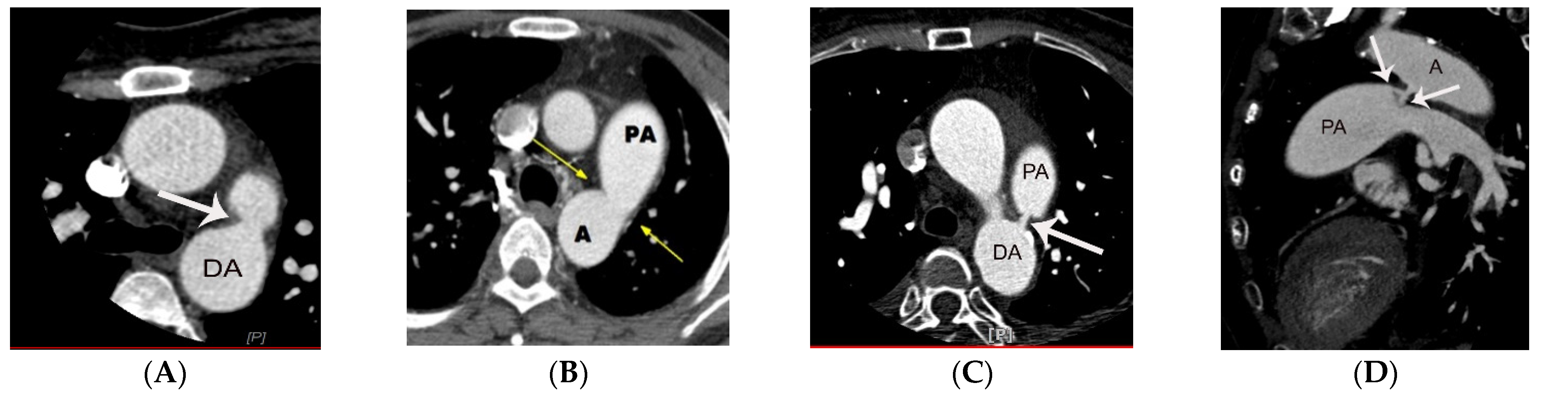Diagnostics 11 02394 g002