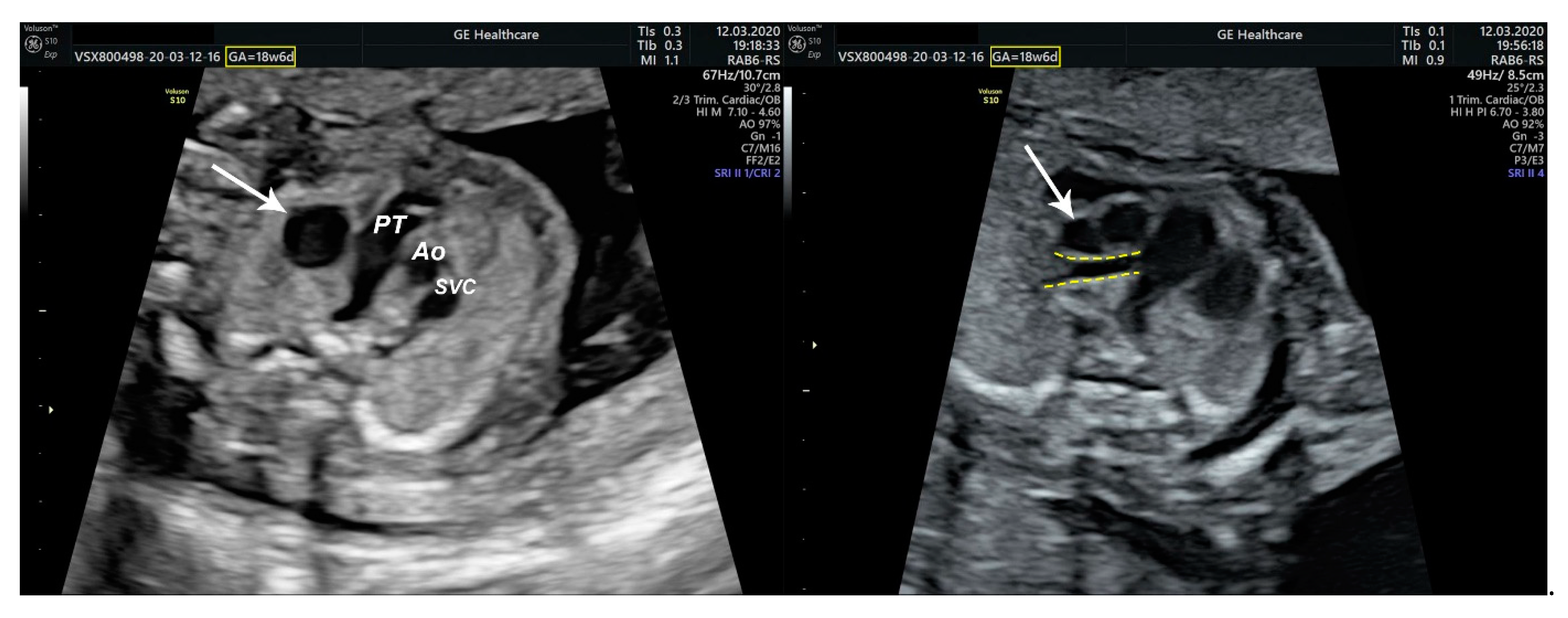 Diagnostics 11 02398 g002