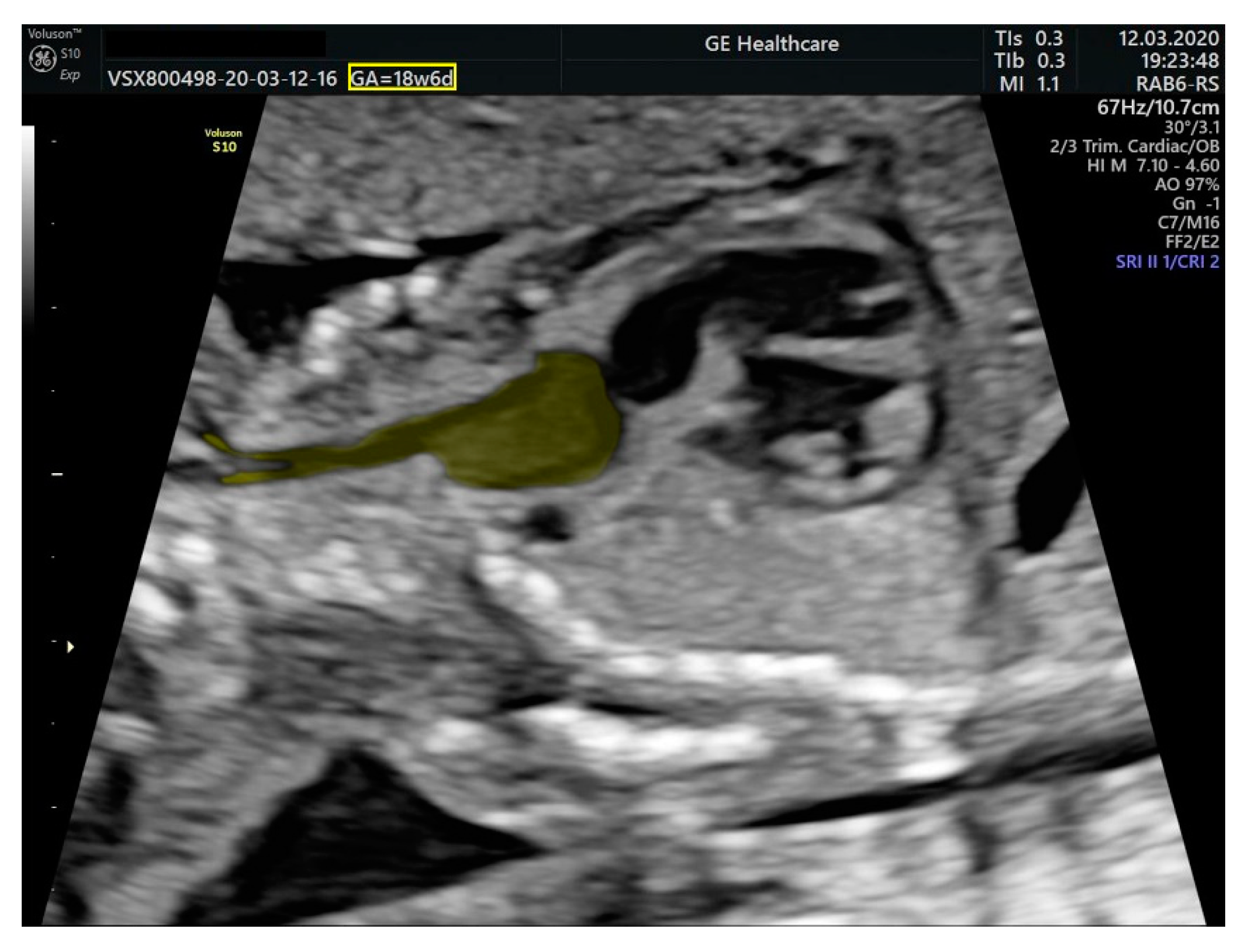 Diagnostics 11 02398 g004