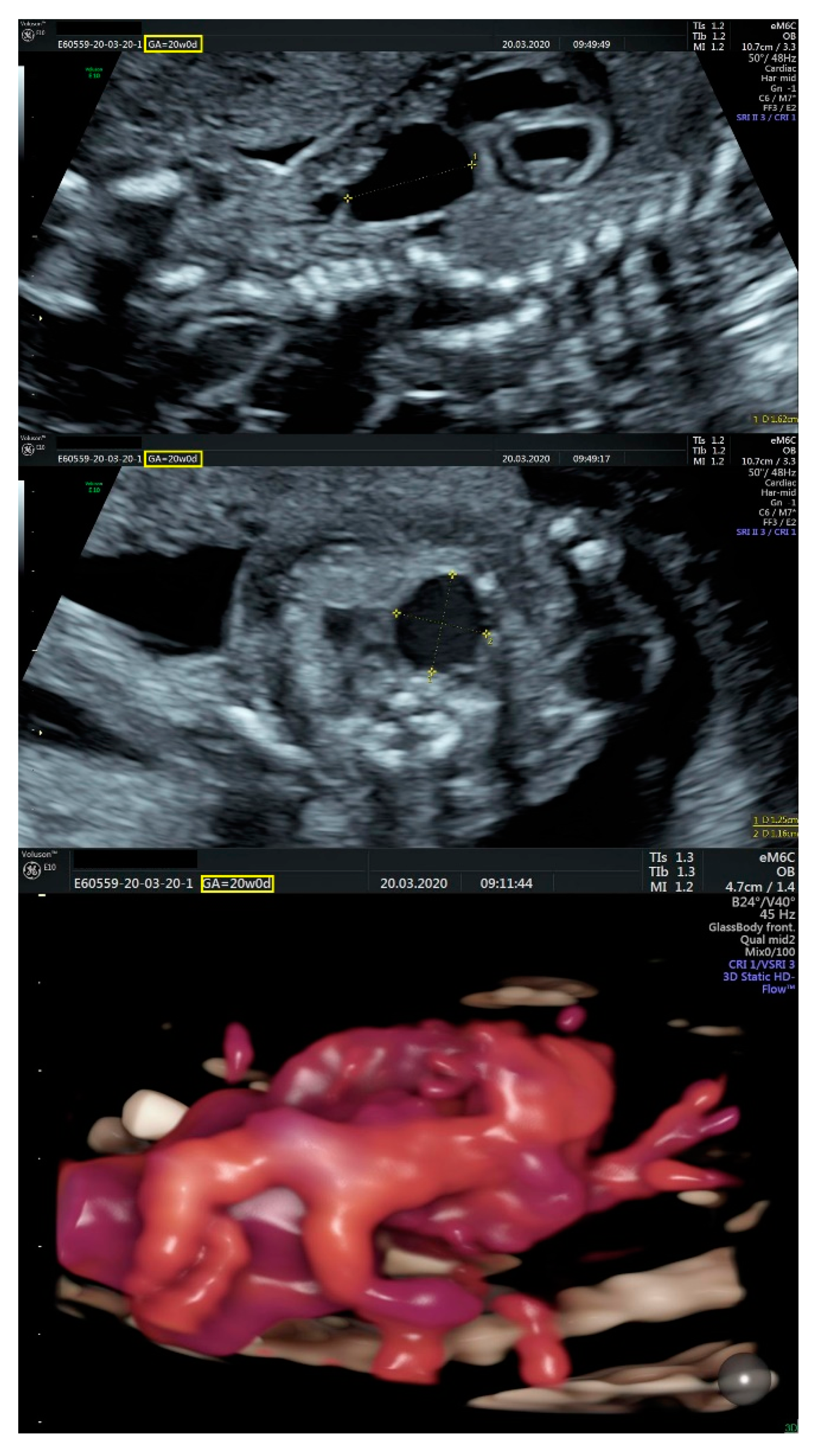 Diagnostics 11 02398 g005