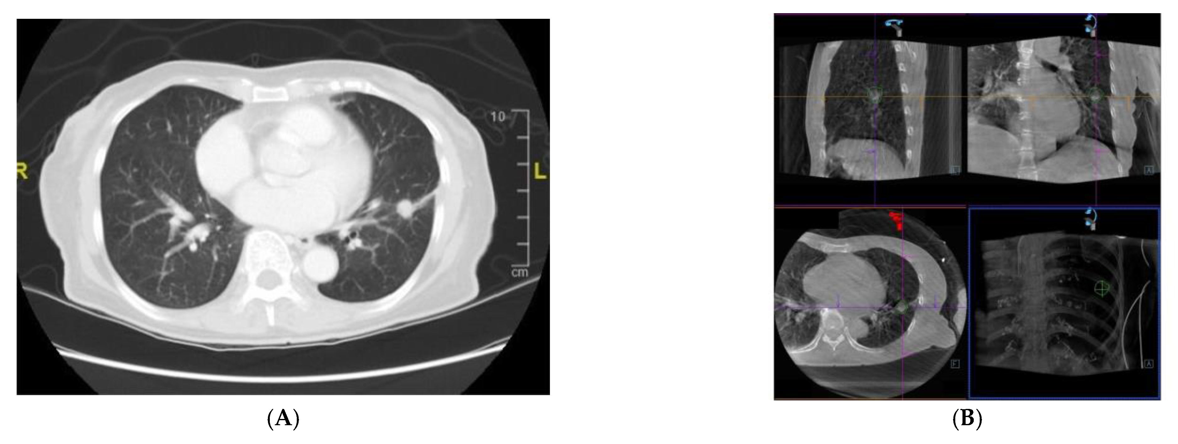 Diagnostics 12 00041 g002a