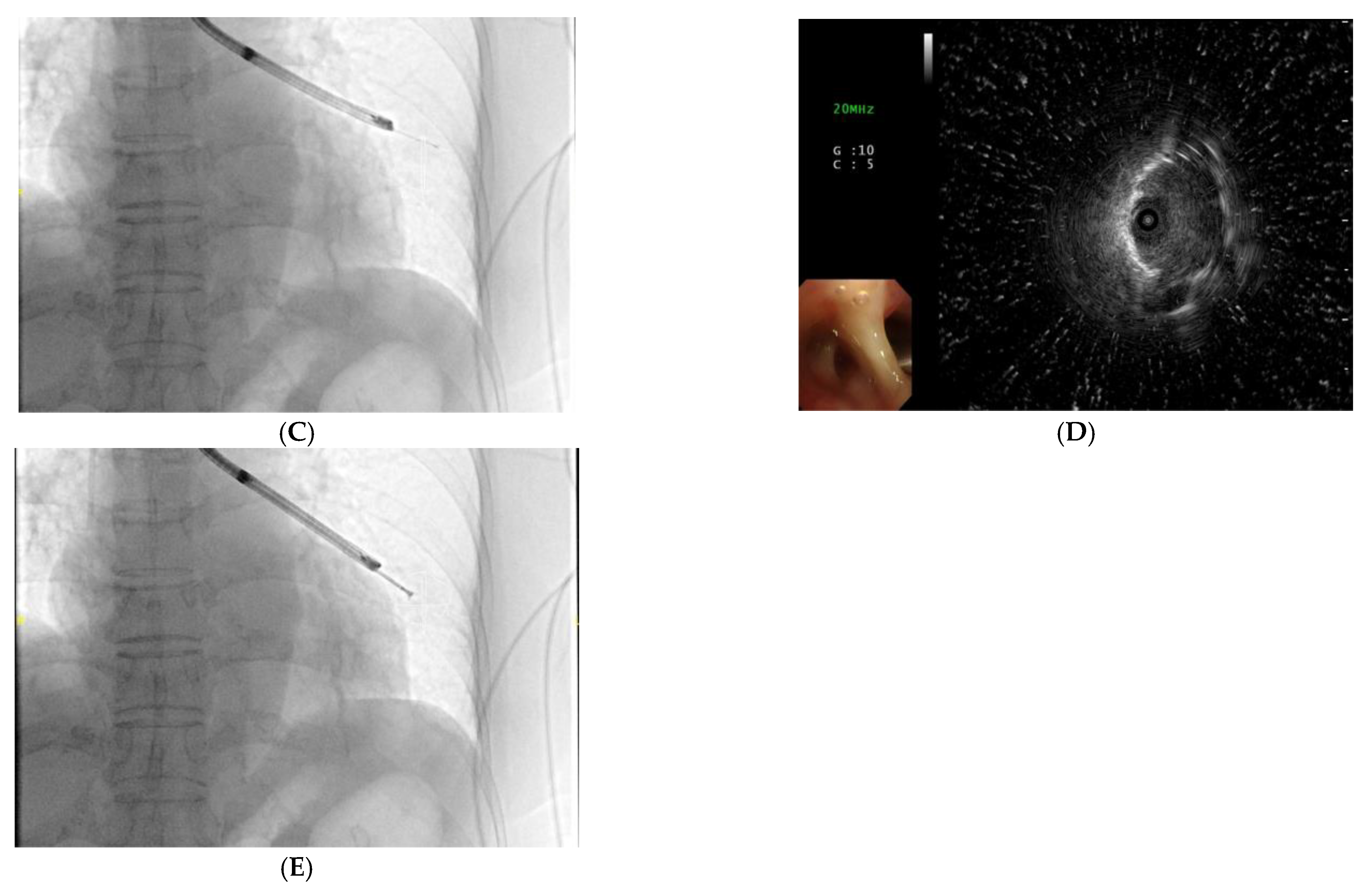 Diagnostics 12 00041 g002b