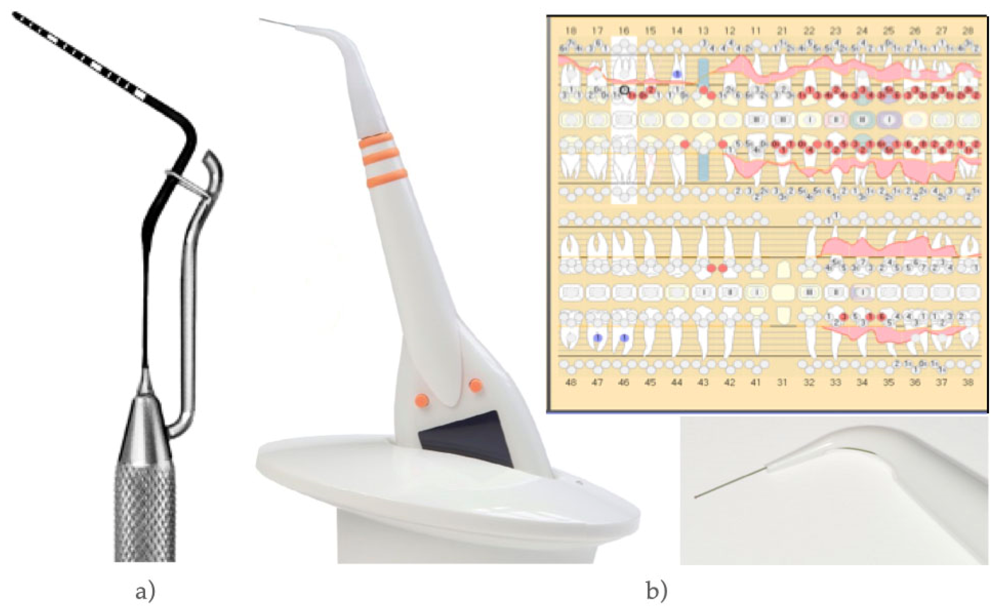 Diagnostics | Free Full-Text | Clinical Evaluation of a New Electronic  Periodontal Probe: A Randomized Controlled Clinical Trial