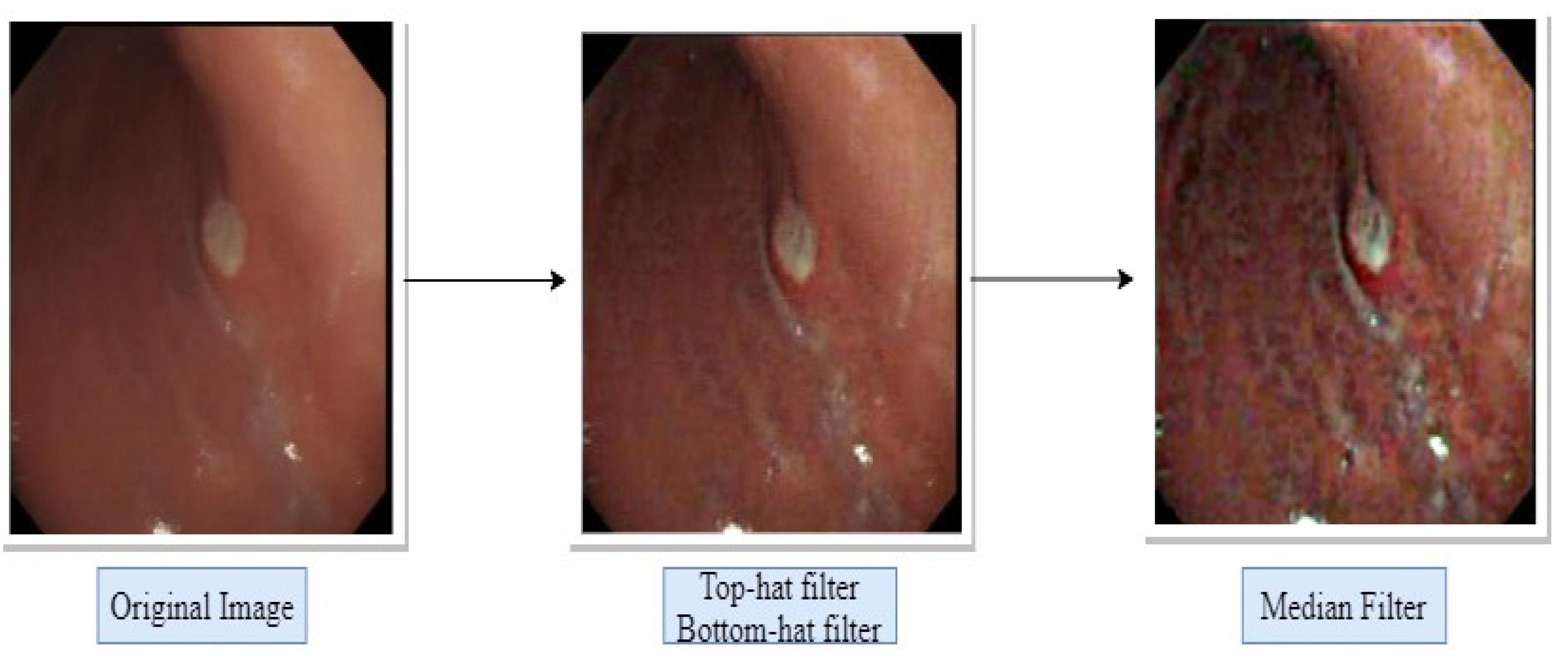 Diagnostics 12 00043 g003 550