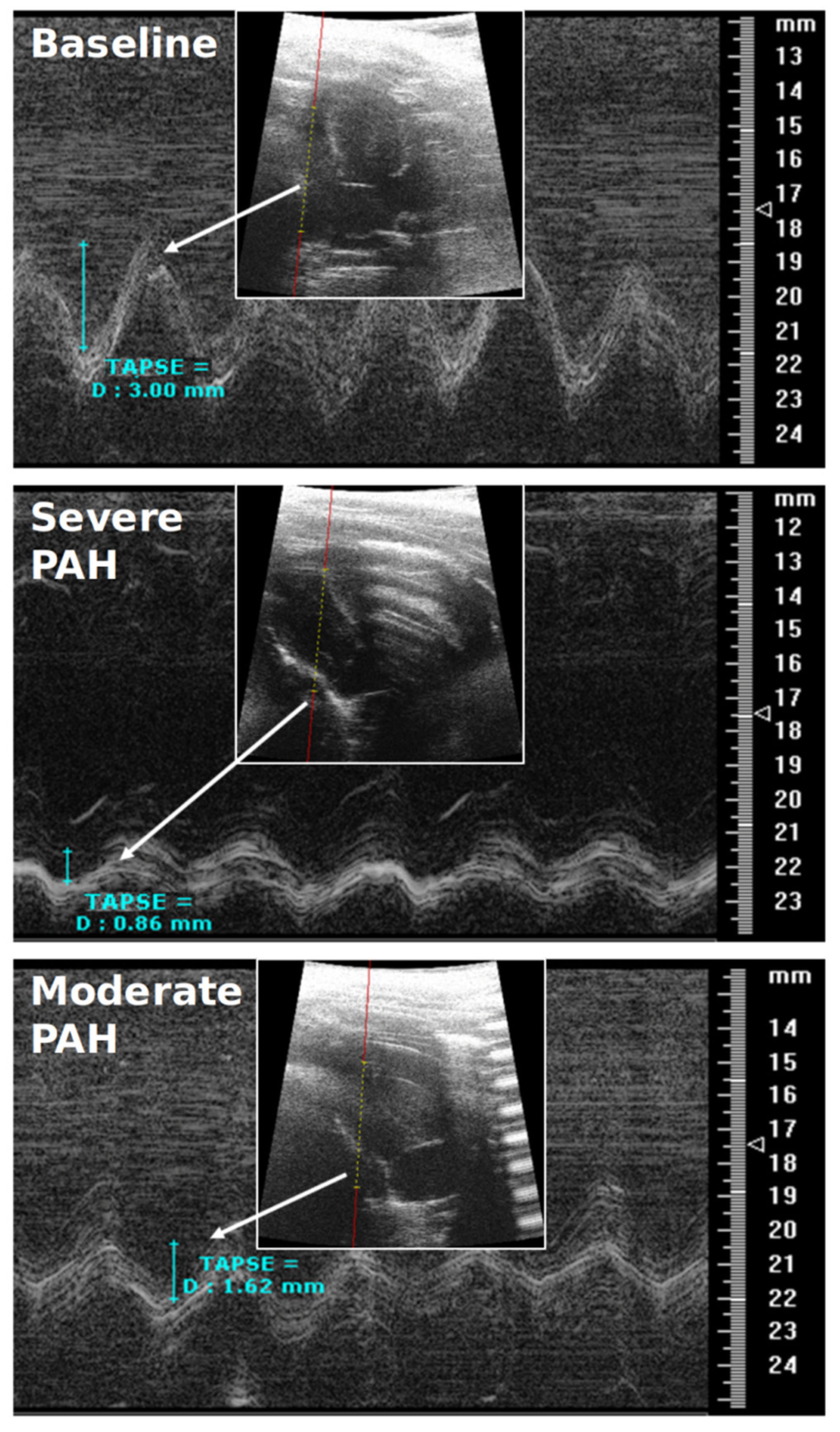 Diagnostics 12 00058 g004