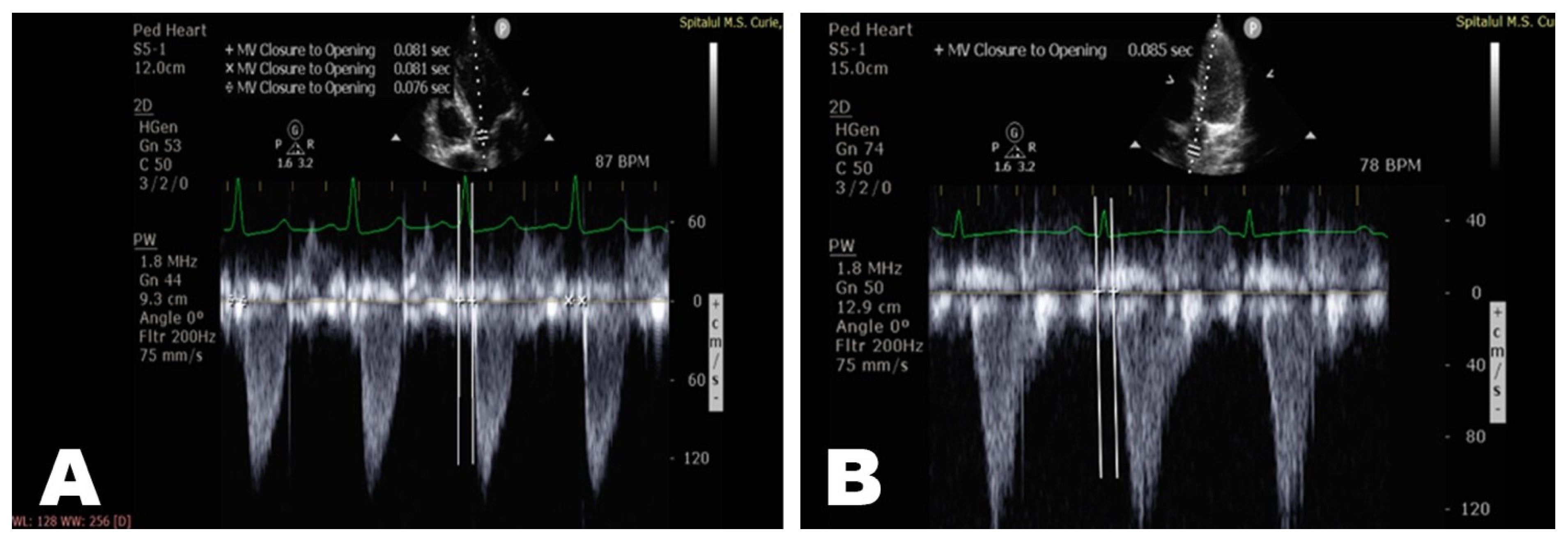 Diagnostics 12 00071 g002 550