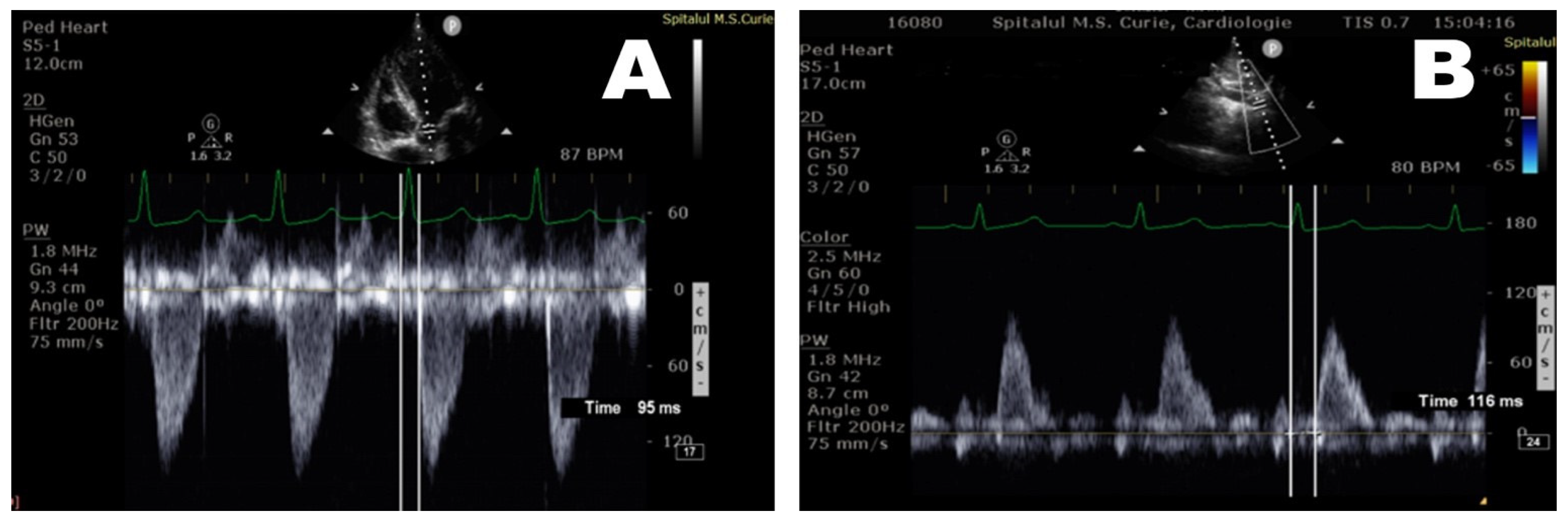 Diagnostics 12 00071 g003 550